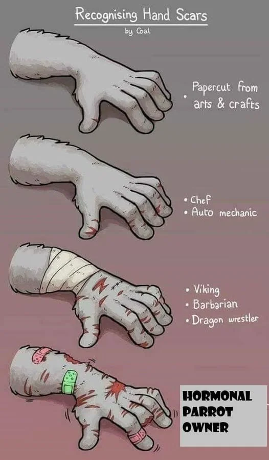 Illustration of four cartoon hands with different levels of scars, labeled from top to bottom: 1. Hand with light scars from arts and crafts, labeled "Papercut from arts & crafts." 2. Hand with moderate scars labeled "Chef" and "Auto mechanic." 3. Hand with more prominent scars, labeled "Viking," "Barbarian," and "Dragon wrestler." 4. Hand with extensive scars, bandages, and a bloodstain, labeled "Hormonal Parrot Owner."