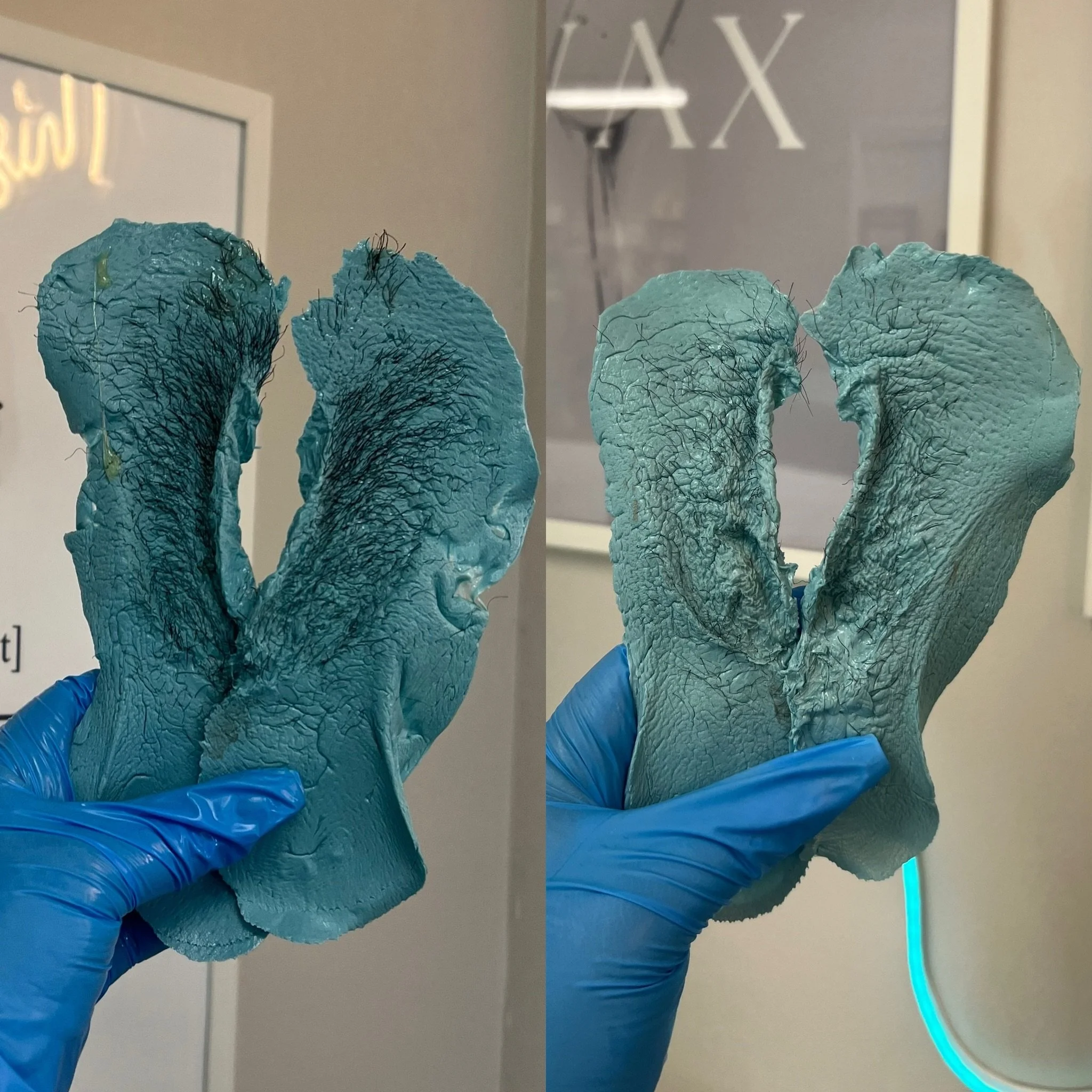 ✨ FIRST BRAZILIAN VS SECOND BRAZILIAN ✨

The difference? 👀

The strip on the left was her FIRST Brazilian wax after weeks of growth. The strip on the right was only SIX WEEKS LATER at her SECOND appointment.

Notice how the hair is already:
✔️ Thinn