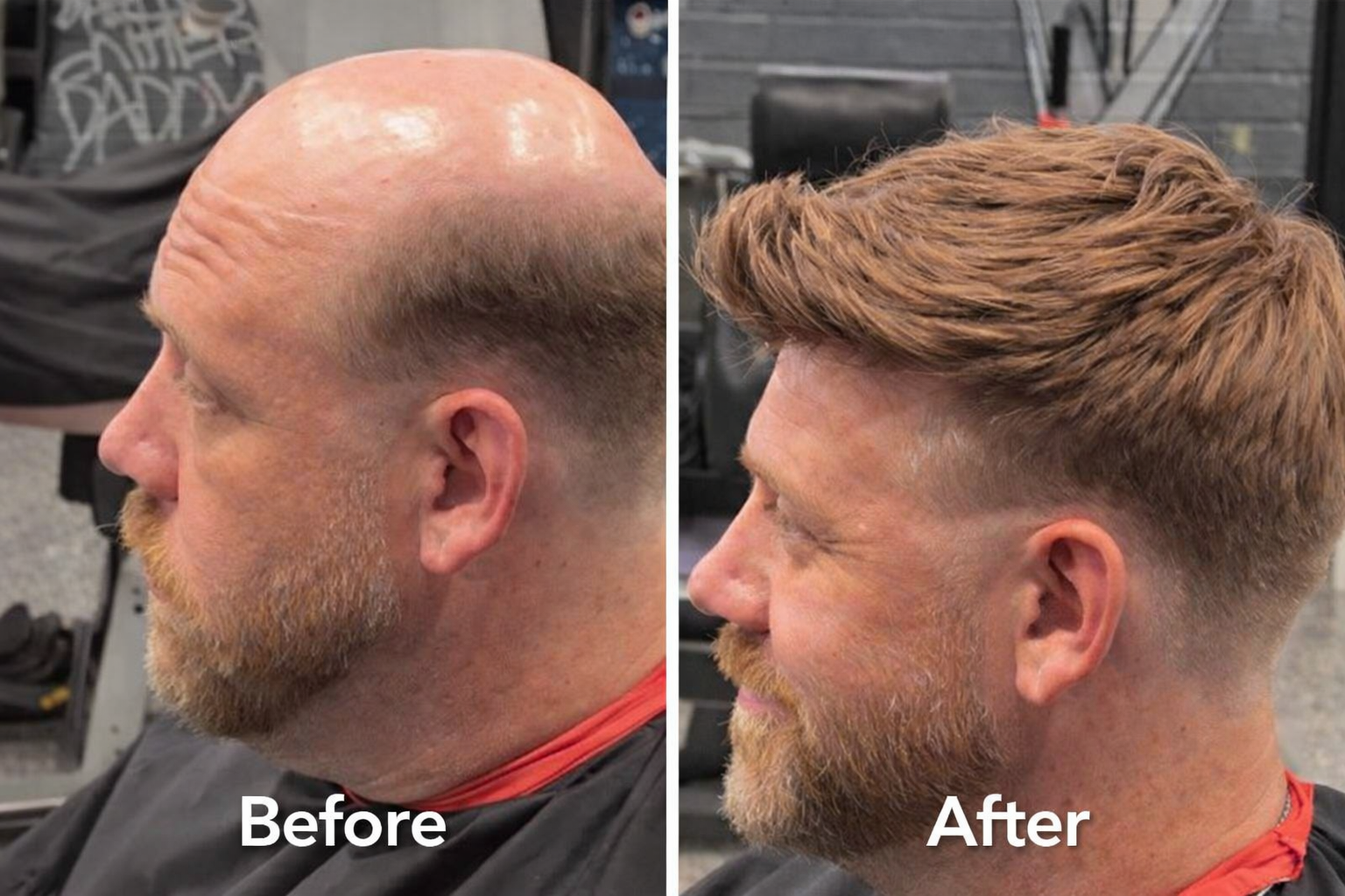 Full Men's Hair Systems