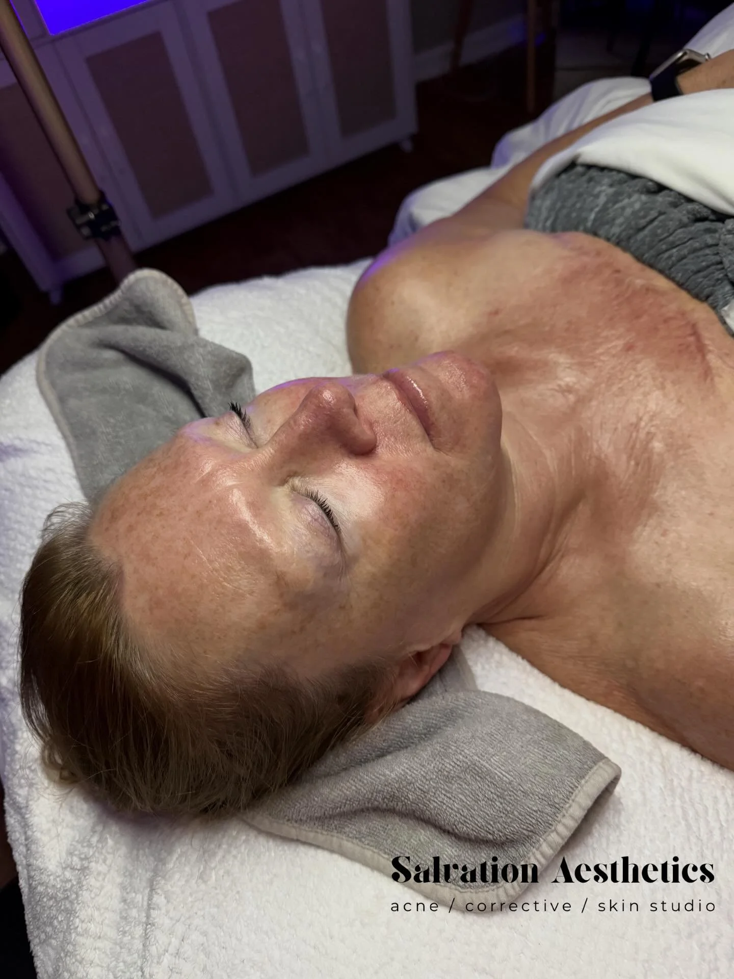 Clients ask me all the time why they still have acne or dry skin when &ldquo;nothing has changed.&rdquo;

Nine times out of ten? Stress

Your skin is your largest organ and it reflects everything happening internally. 

Cortisol disrupts oil balance.