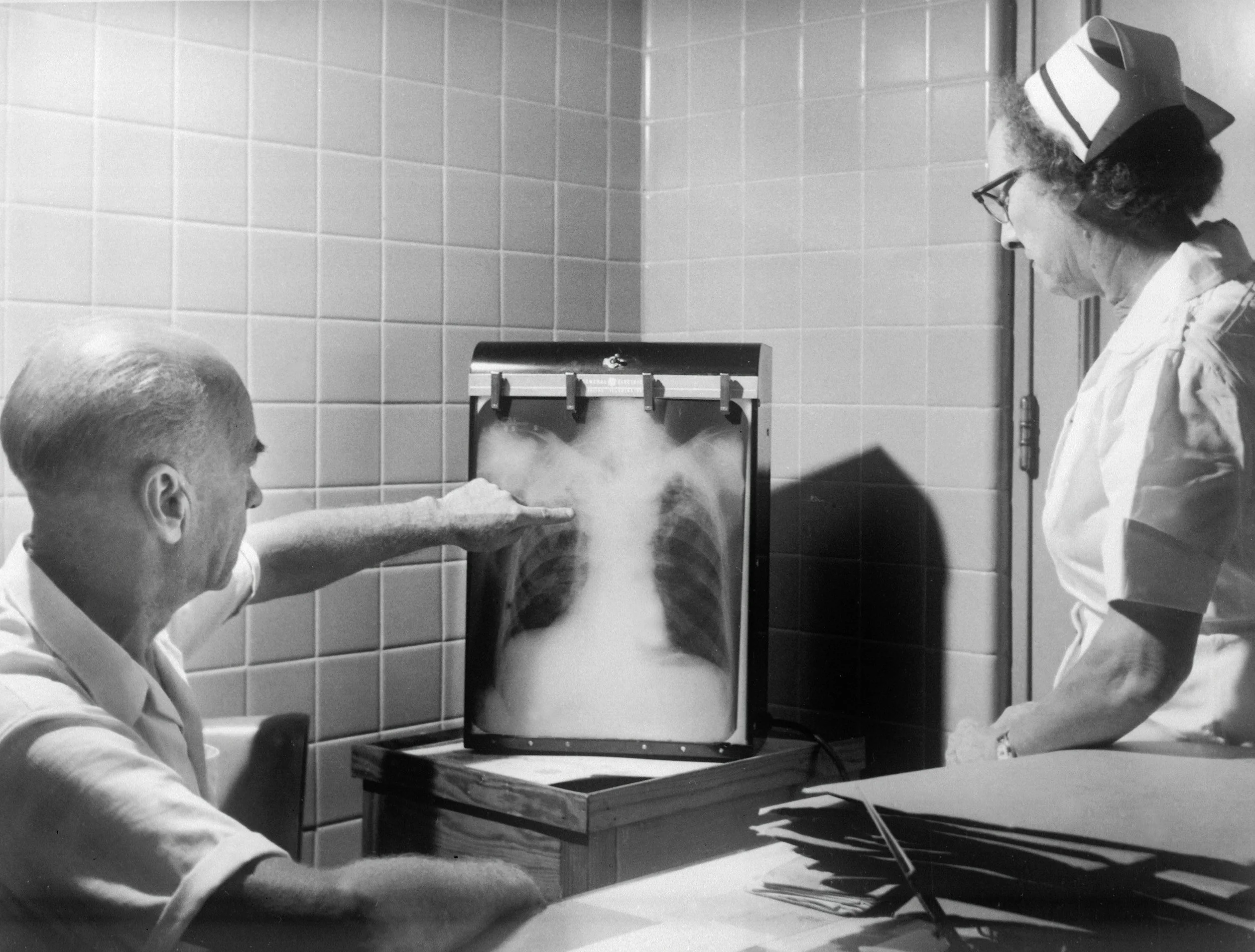 Tuberculosis 