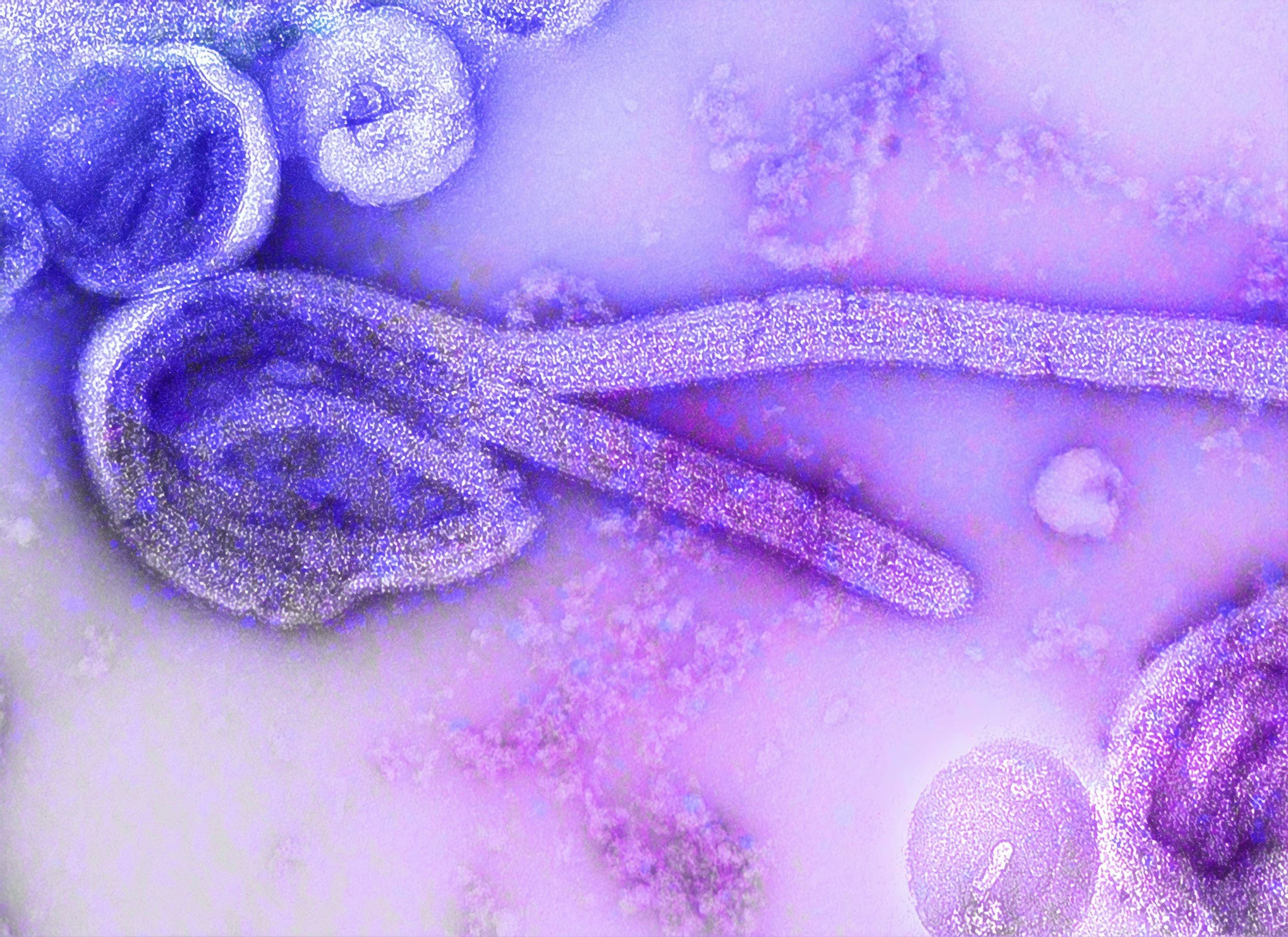 Ebola Virus Disease (EVD)