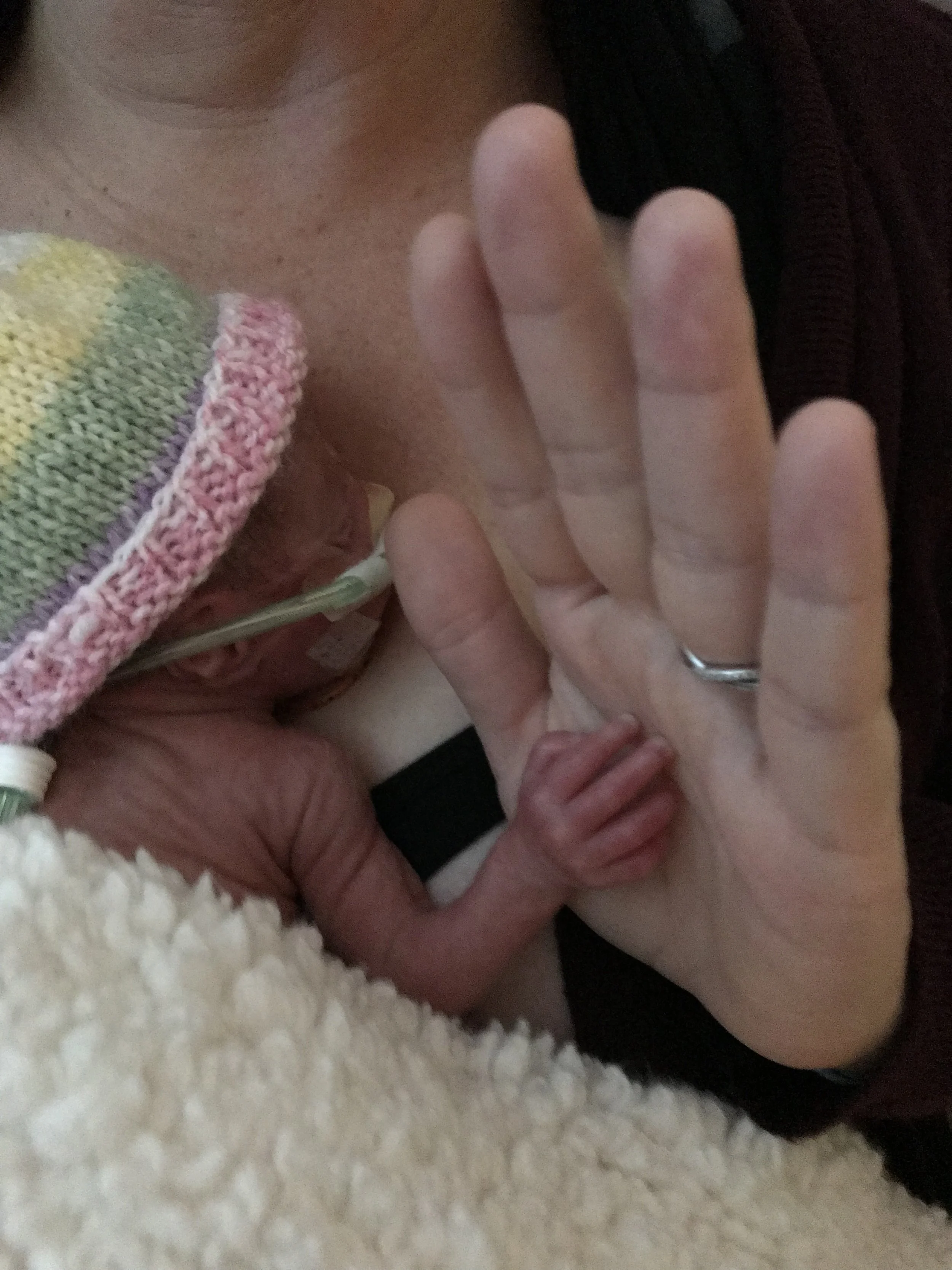 Micro preemie hand to hand with her mom during a long NICU stay.