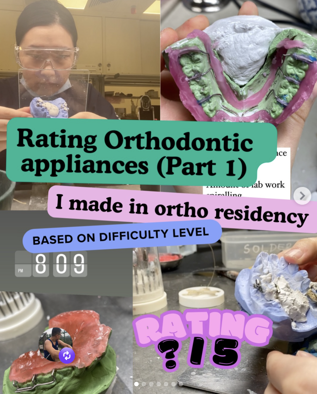 Rating orthodontic appliances I made in ortho residency (based on difficulty level) 