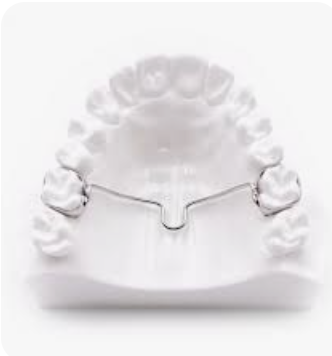 Your guide to the transpalatal arch and lingual arch