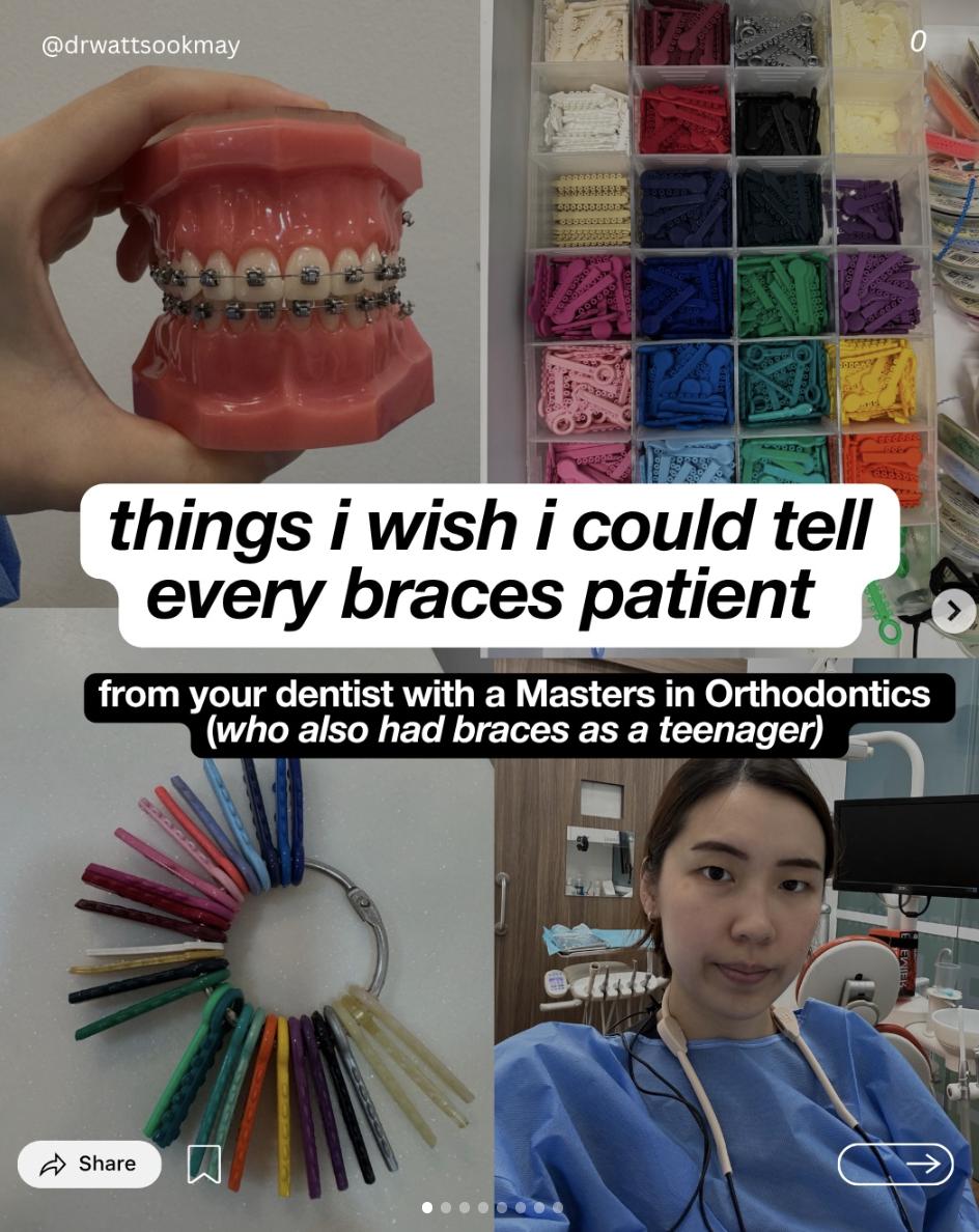Things I Wish I Could Tell Every Braces Patient