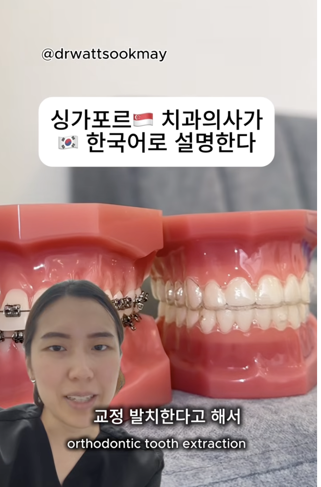 Will orthodontic extractions flatten my face? 