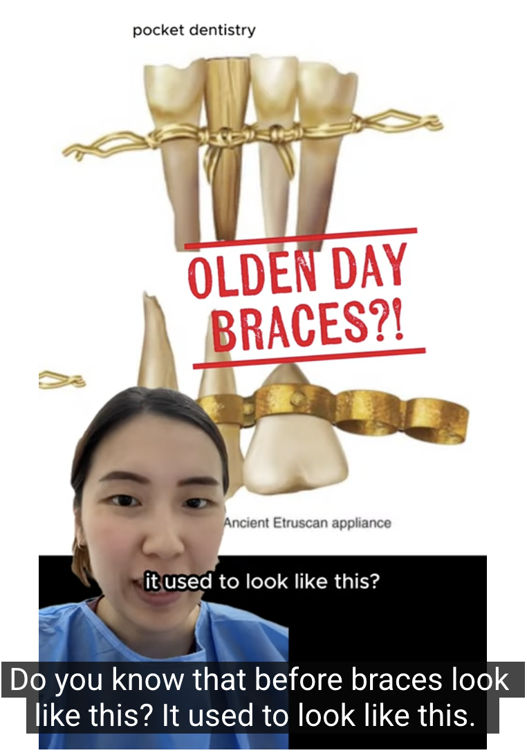 How Braces Work — And Why They Look Nothing Like They Used To