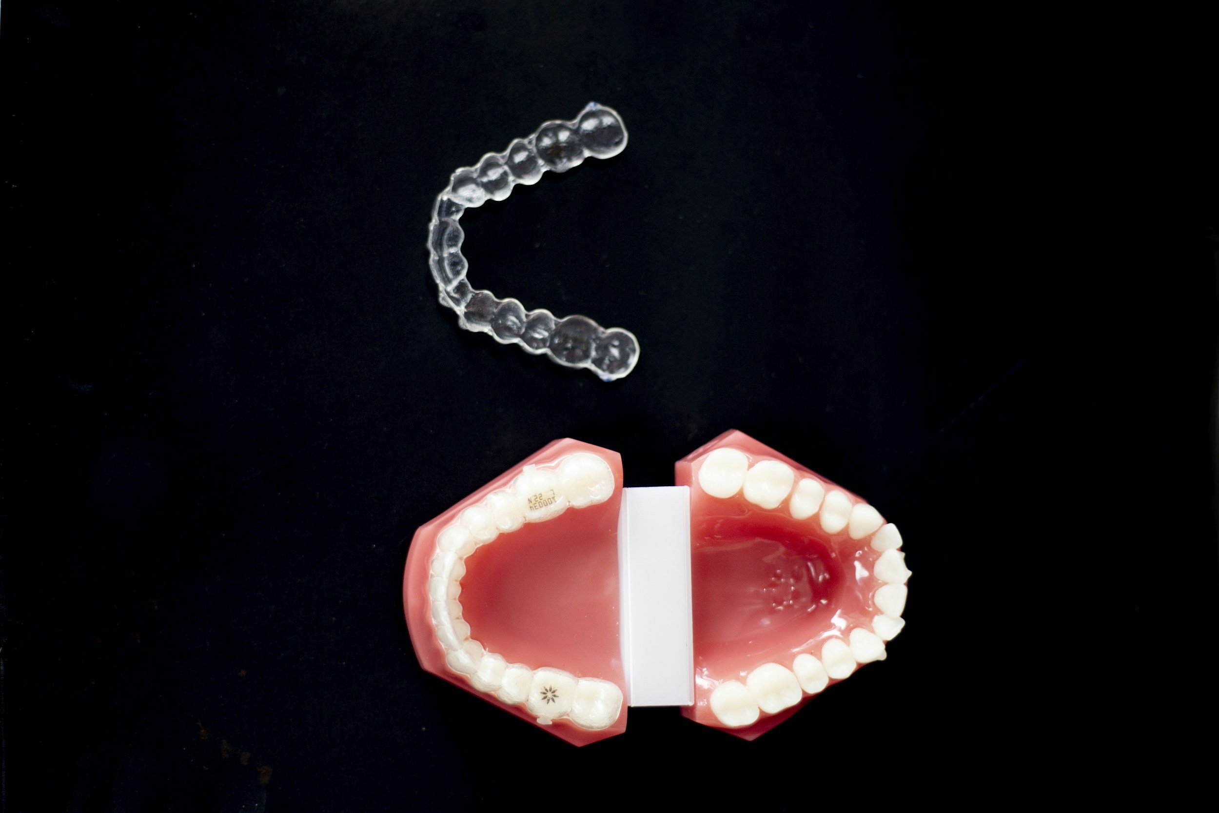 How clear aligner / Invisalign treatment is actually planned
