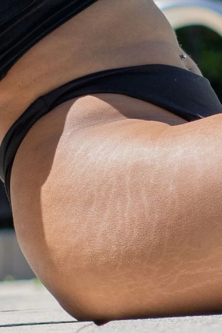 Close-up of smooth bikini line after Brazilian wax, showing clean, hair-free skin with professional waxing results