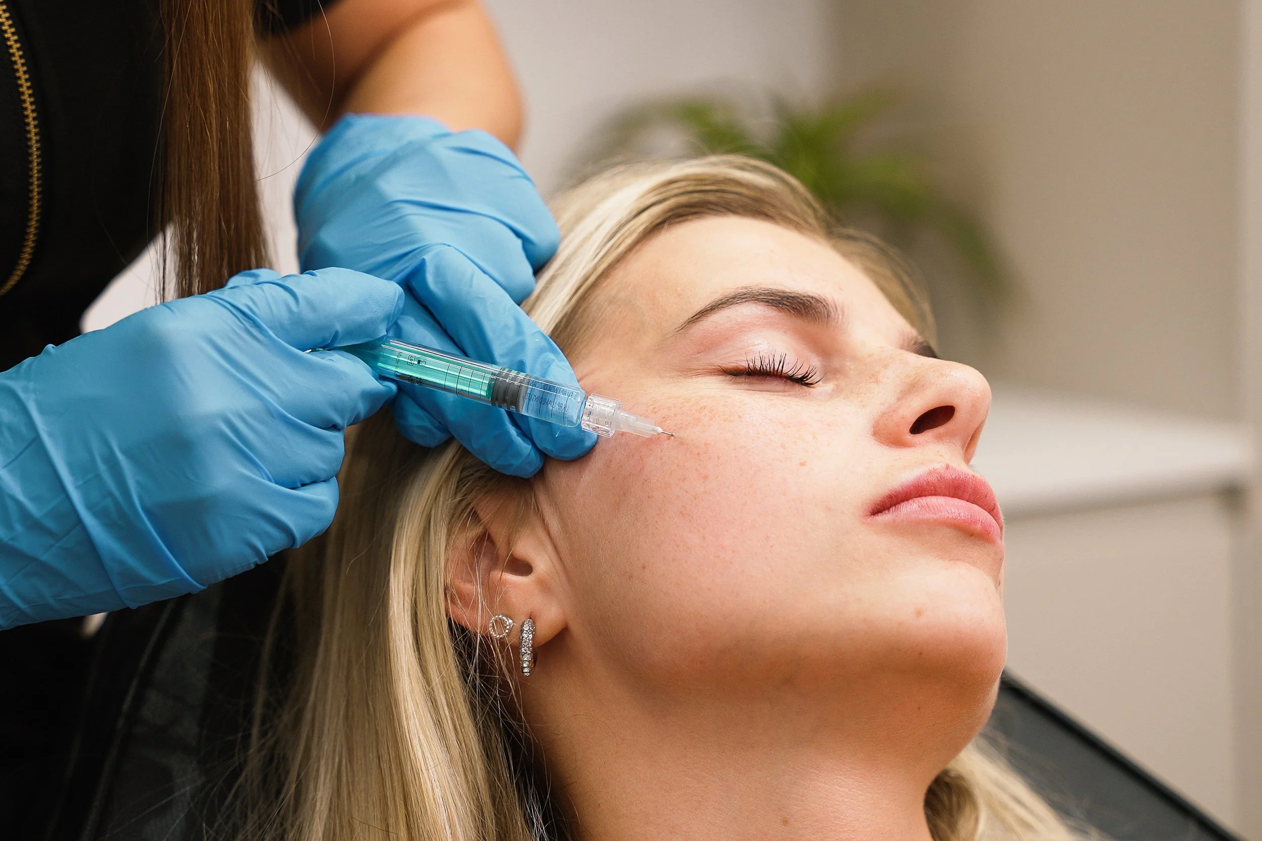 Dermal Filler