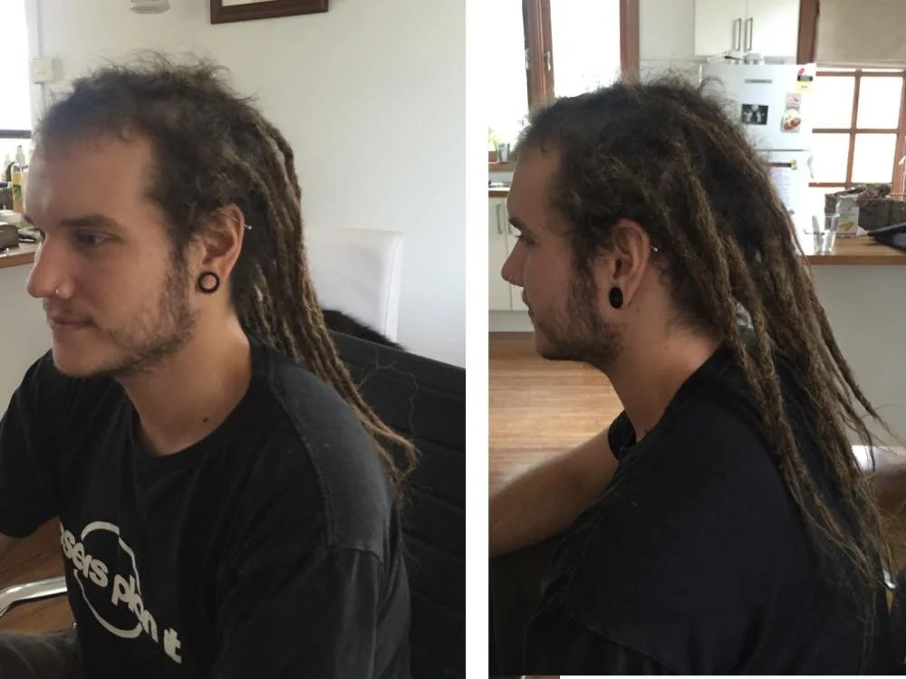 thinning dreads