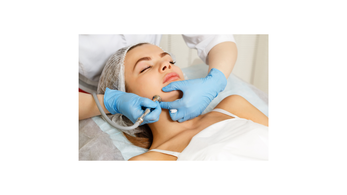 Microdermabrasion