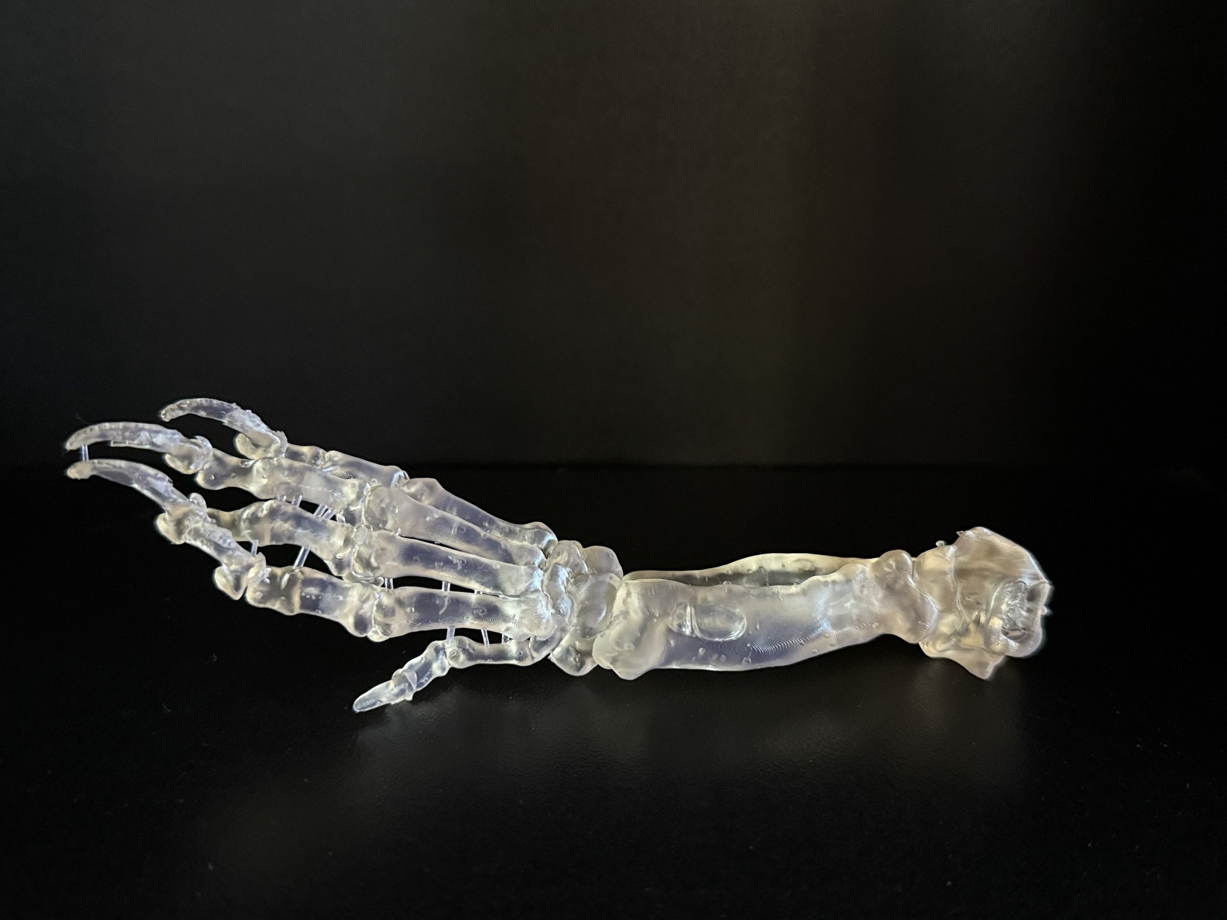 Patient-specific anatomic model