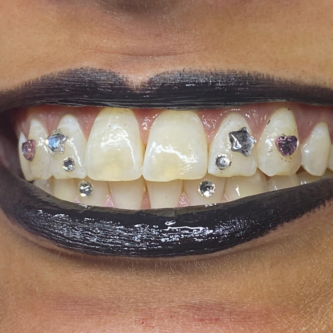 Close-up of a person's mouth with black lipstick, showing teeth with colorful dental gems.