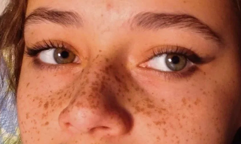 Close-up of a person's face showing green eyes, freckles, and light brown hair.