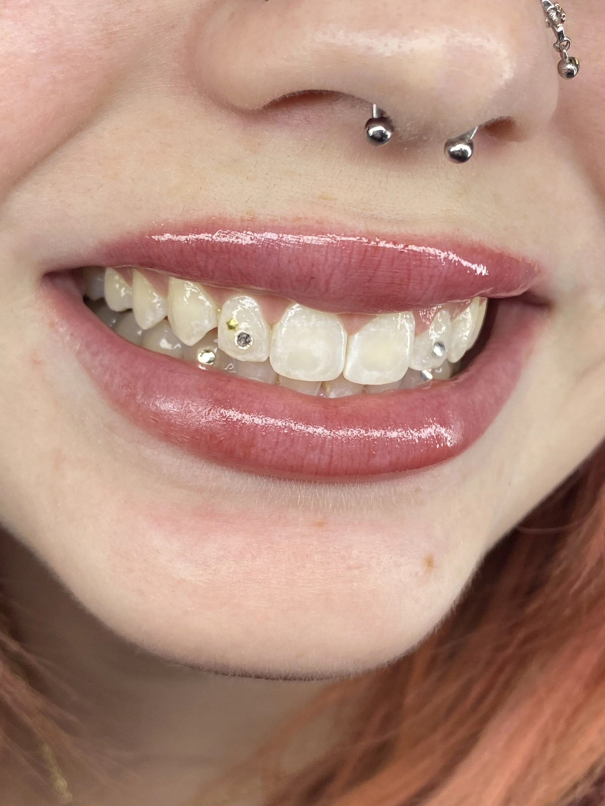 Close-up of a smiling person's mouth with lip gloss, multiple silver and gold dental piercings, and teeth with small decorative rhinestones.