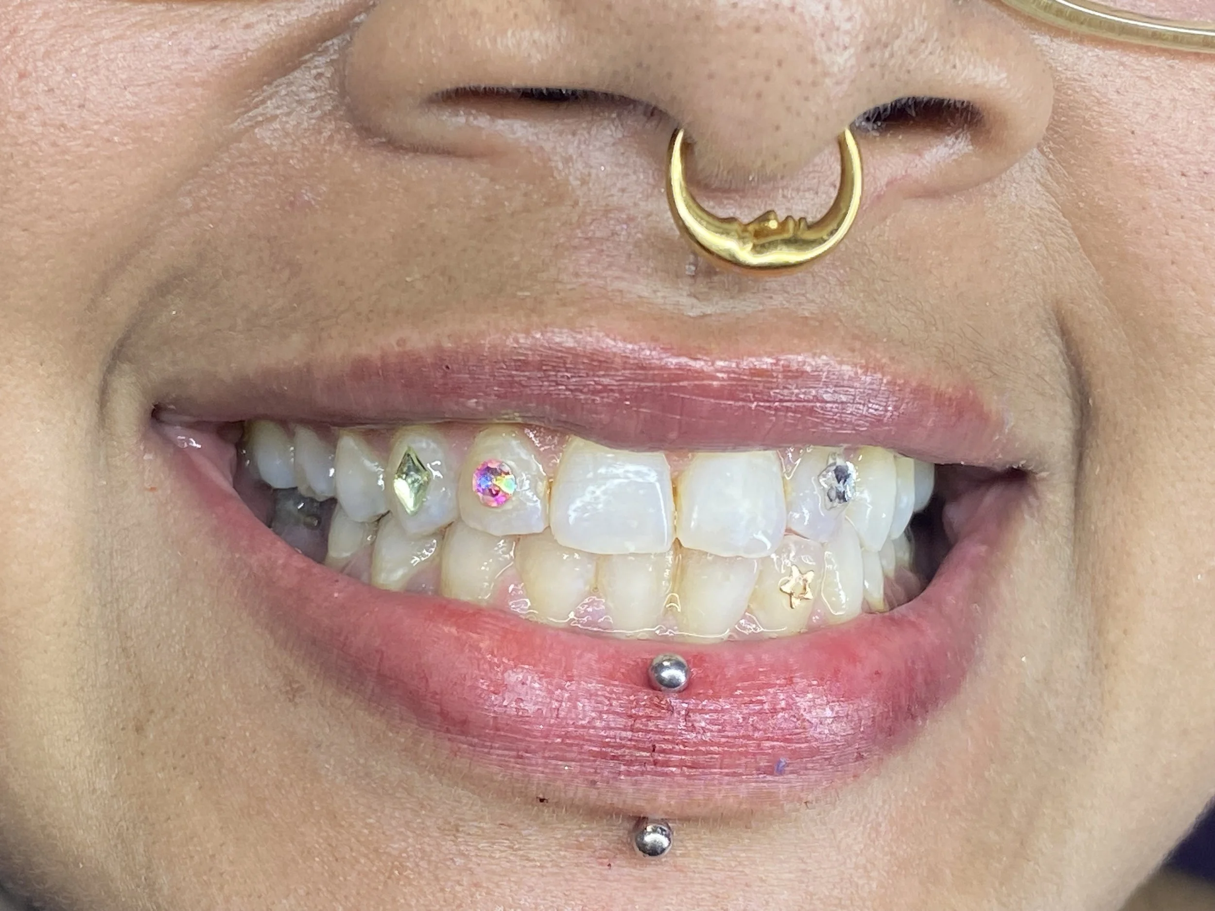 Close-up of a person's smile showing teeth decorated with colorful rhinestones, a gold septum ring, and a lip piercing with a silver ball.