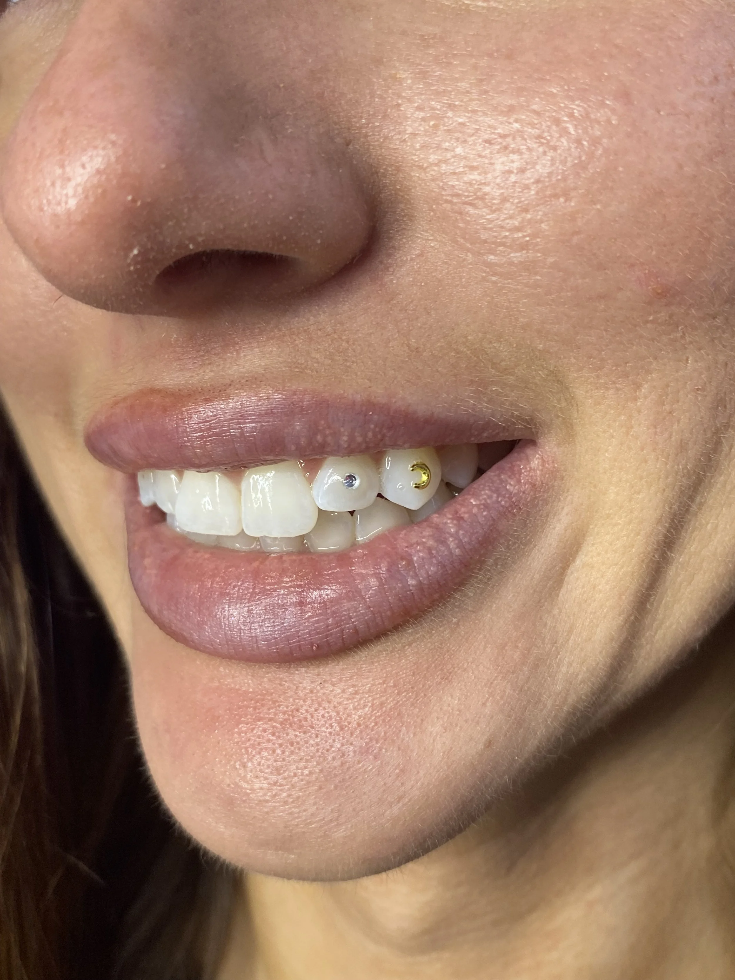 Close-up of a person's mouth showing teeth with small facial piercings on two front teeth.