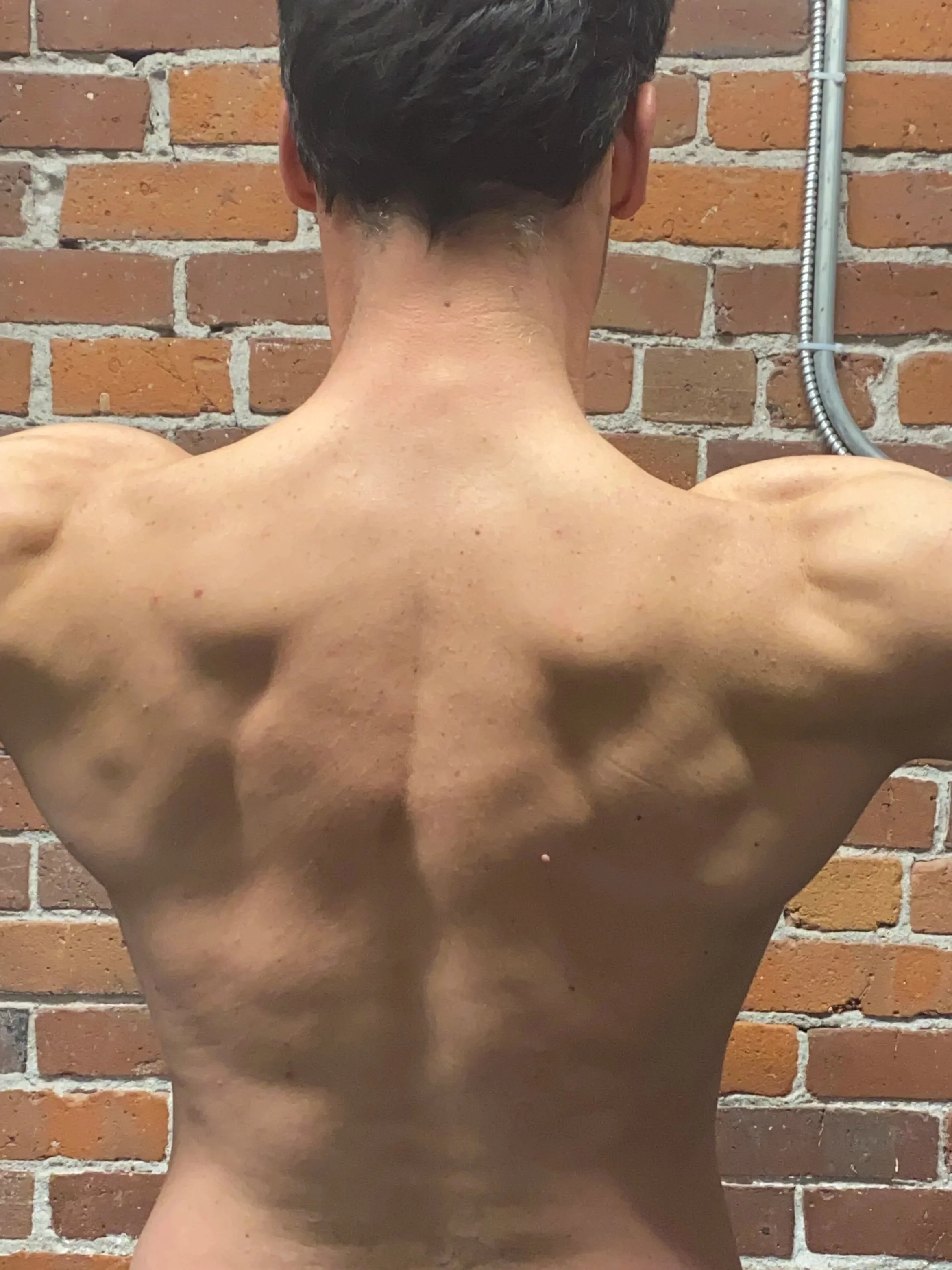 The Recovery Journey Continues: What the Images Revealed