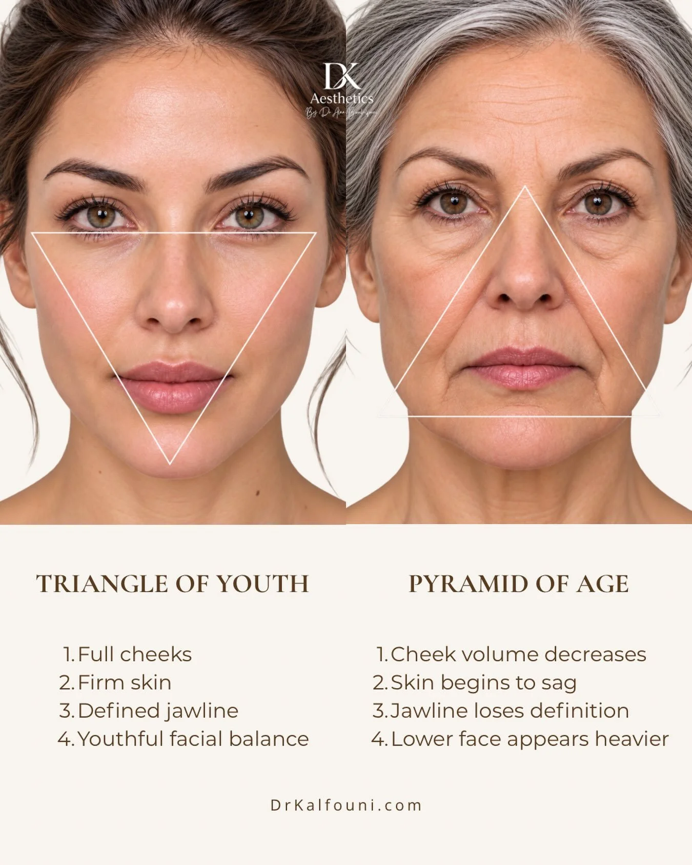 🔺The Triangle of Youth vs. The Pyramid of Age

Have you ever wondered why the face can look heavier as we age&mdash;even when our weight has not changed?

🧬 Facial ageing is not simply loose skin. Collagen, facial fat, connective tissues, and even 