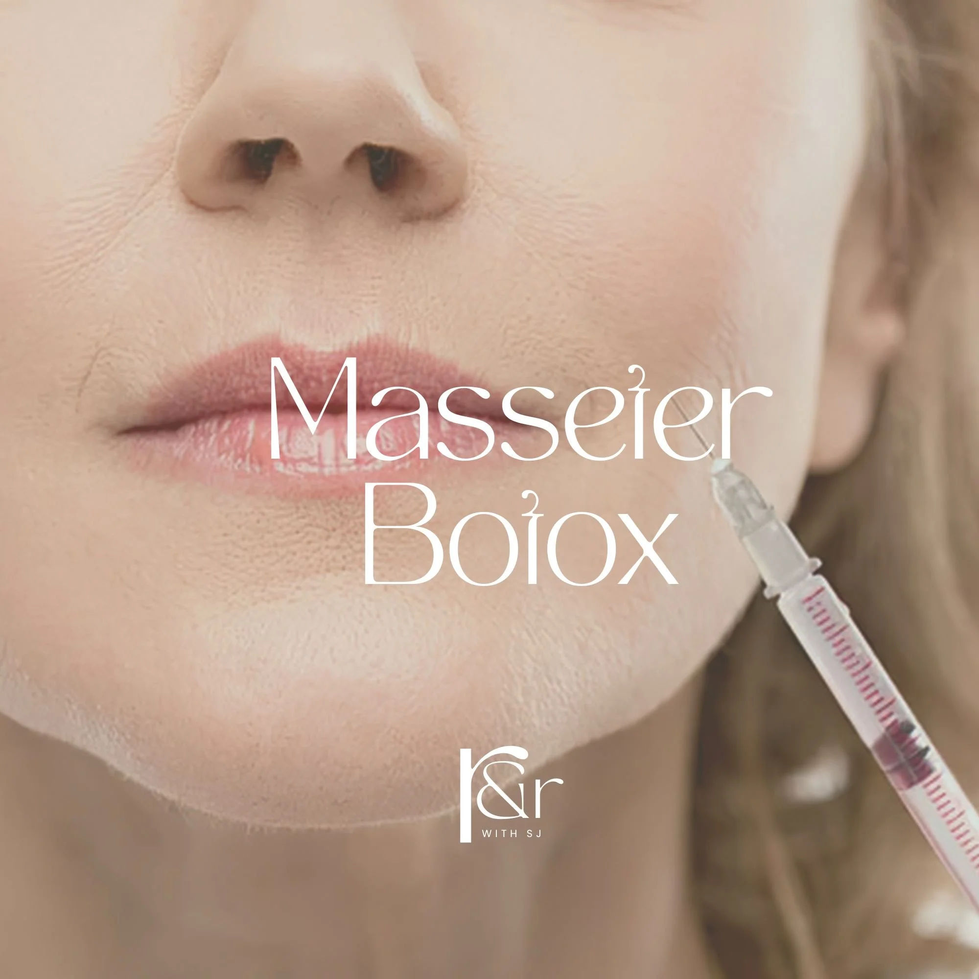 Close-up of a woman receiving a Botox injection in her cheek, with text overlay 'Massier Botox' and a logo with 'r' and 'WITH SJ'.