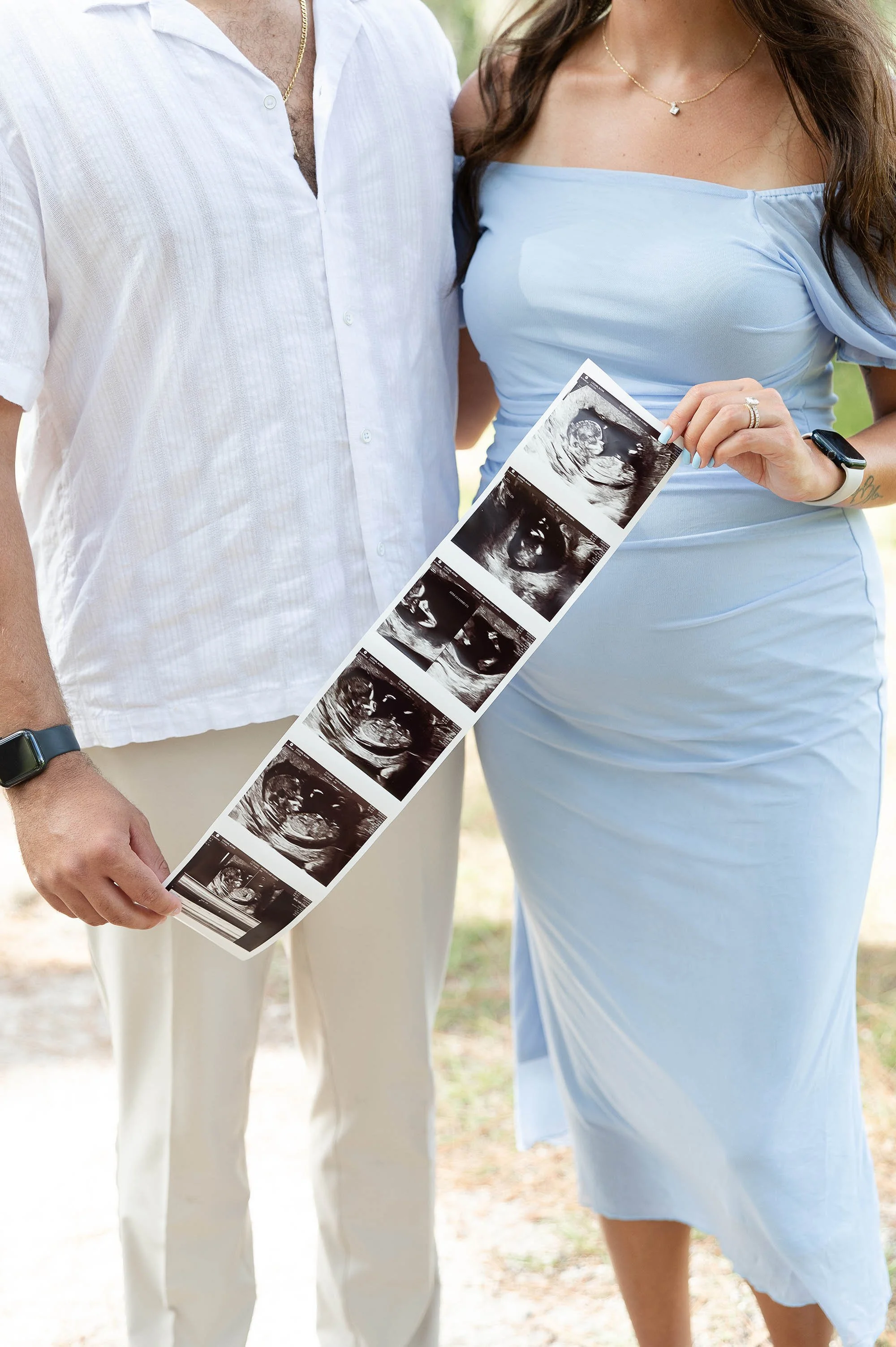 Ultrasound-Photo-Announcement-Central-Florida.jpg