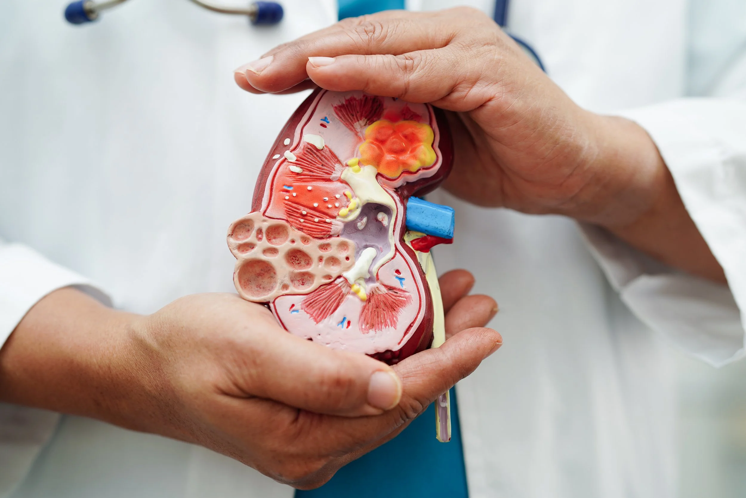 Medical model of a human kidneys showing internal structures, held by a healthcare professional.