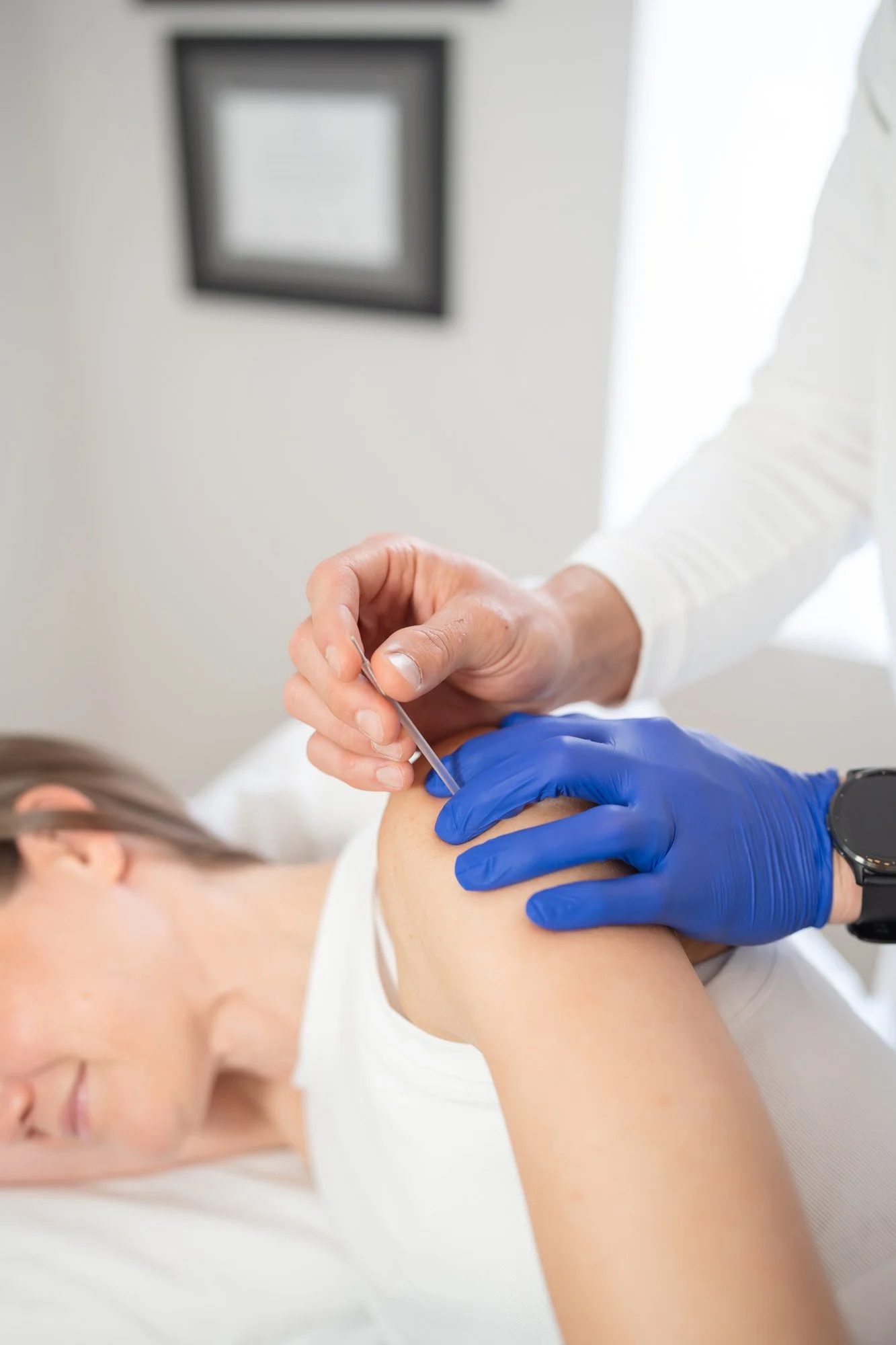 trigger point dry needling
