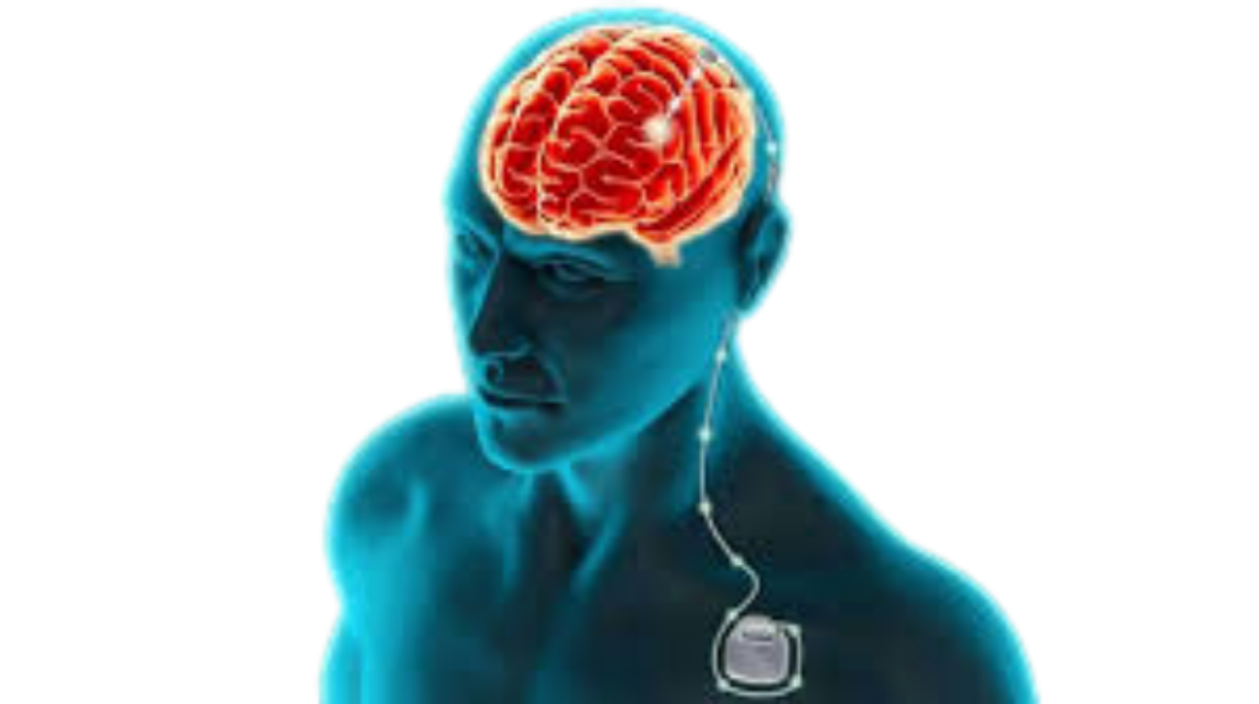Img 1.png