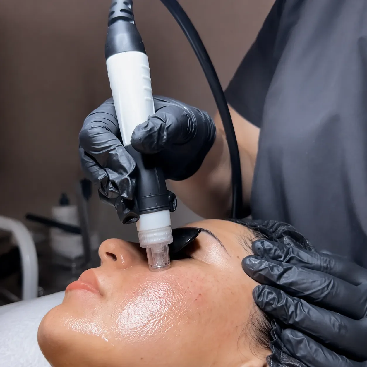 A person lying down receiving a facial treatment with a handheld device applied to their face by a technician in black gloves.