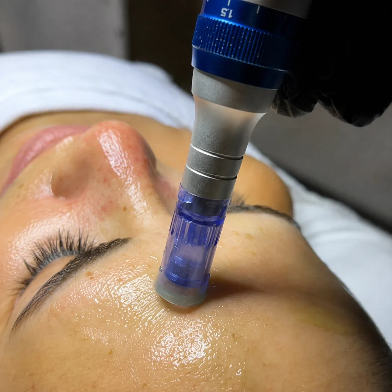 A close-up of a person receiving a facial treatment with a device applied to their forehead, lying on a treatment bed with closed eyes.