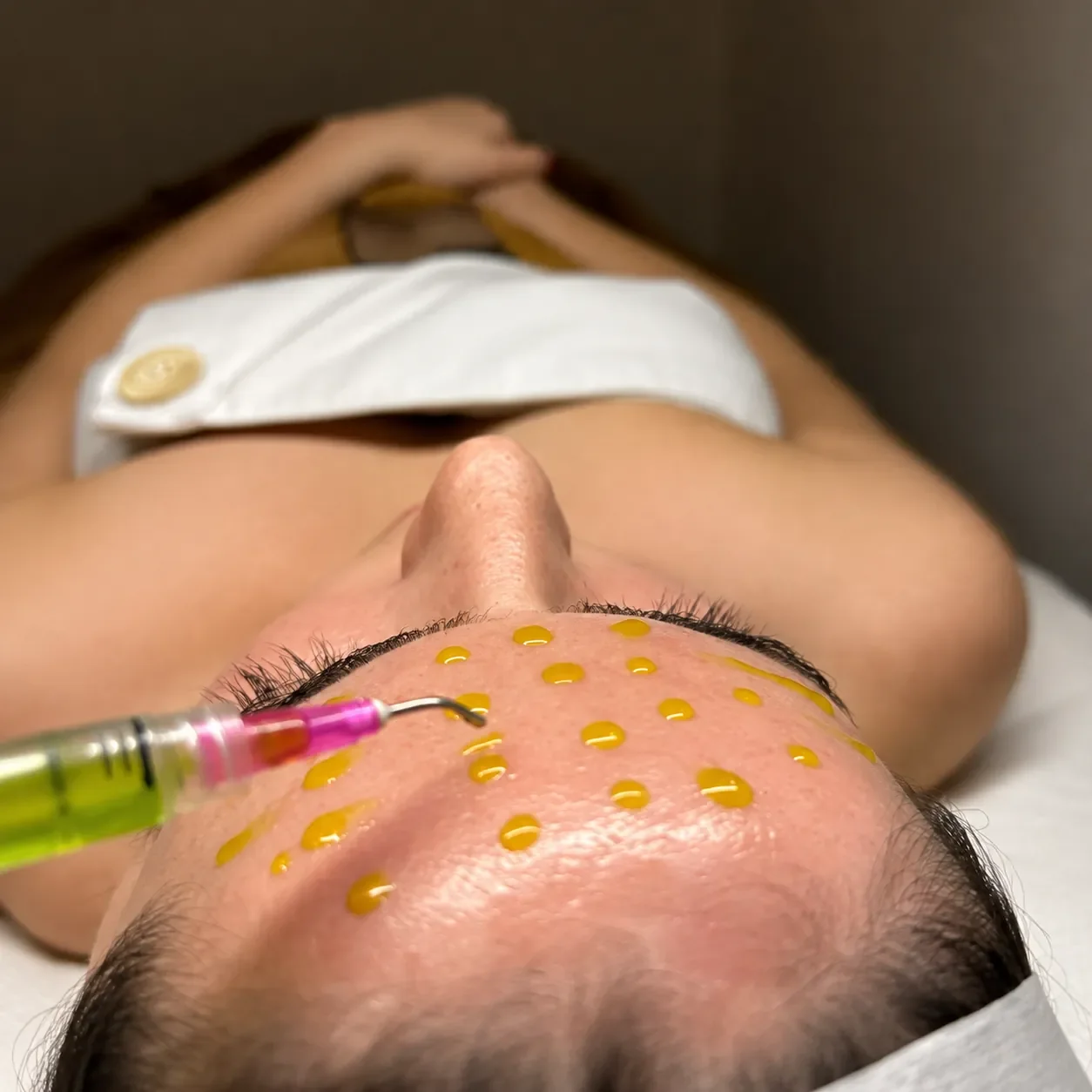 A person receiving a facial treatment with yellow dots on their forehead, and a skincare device being applied to the forehead.