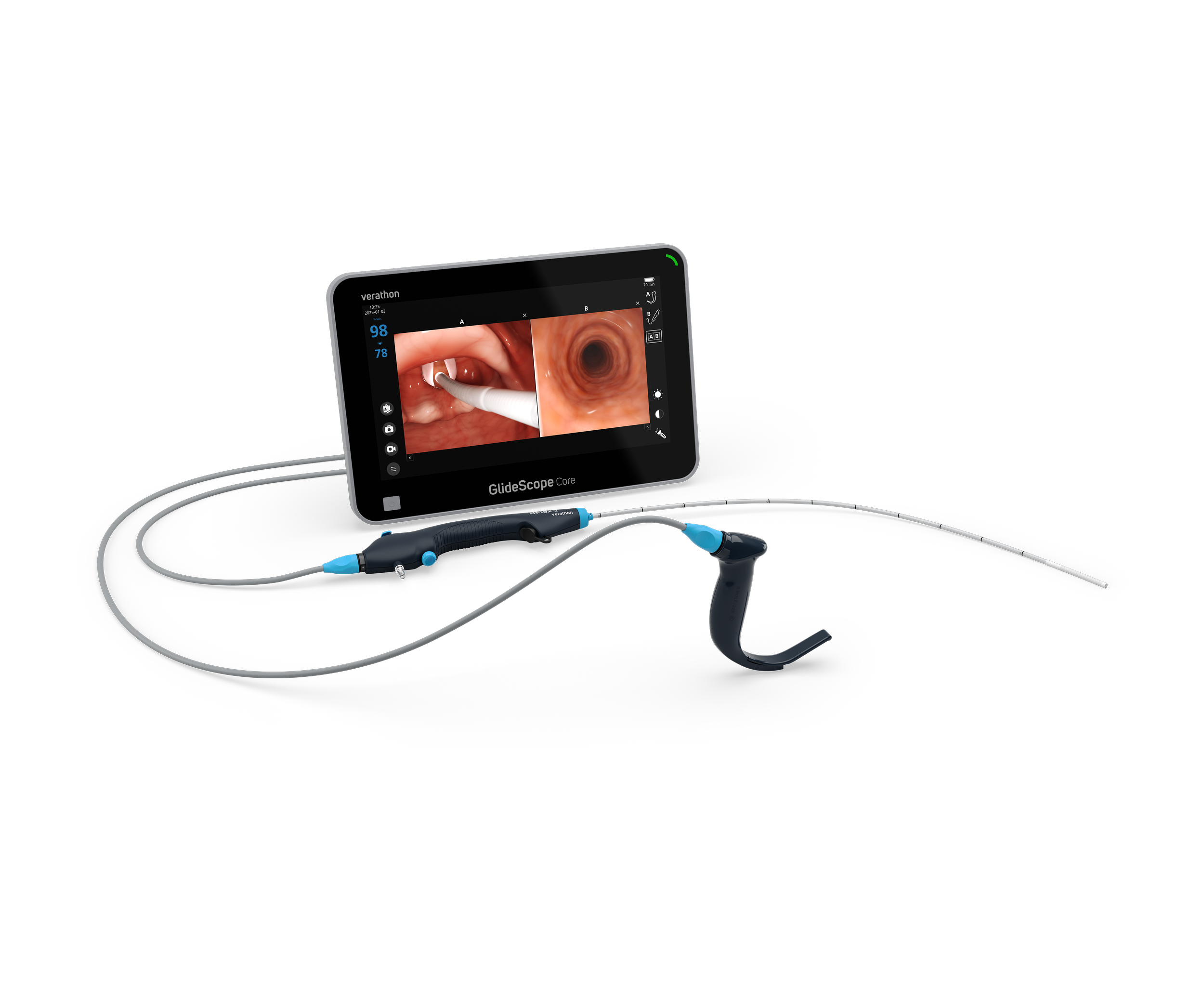 A medical device screen displaying images of the inside of a patient's throat during a medical examination, with attached medical instruments and cables.