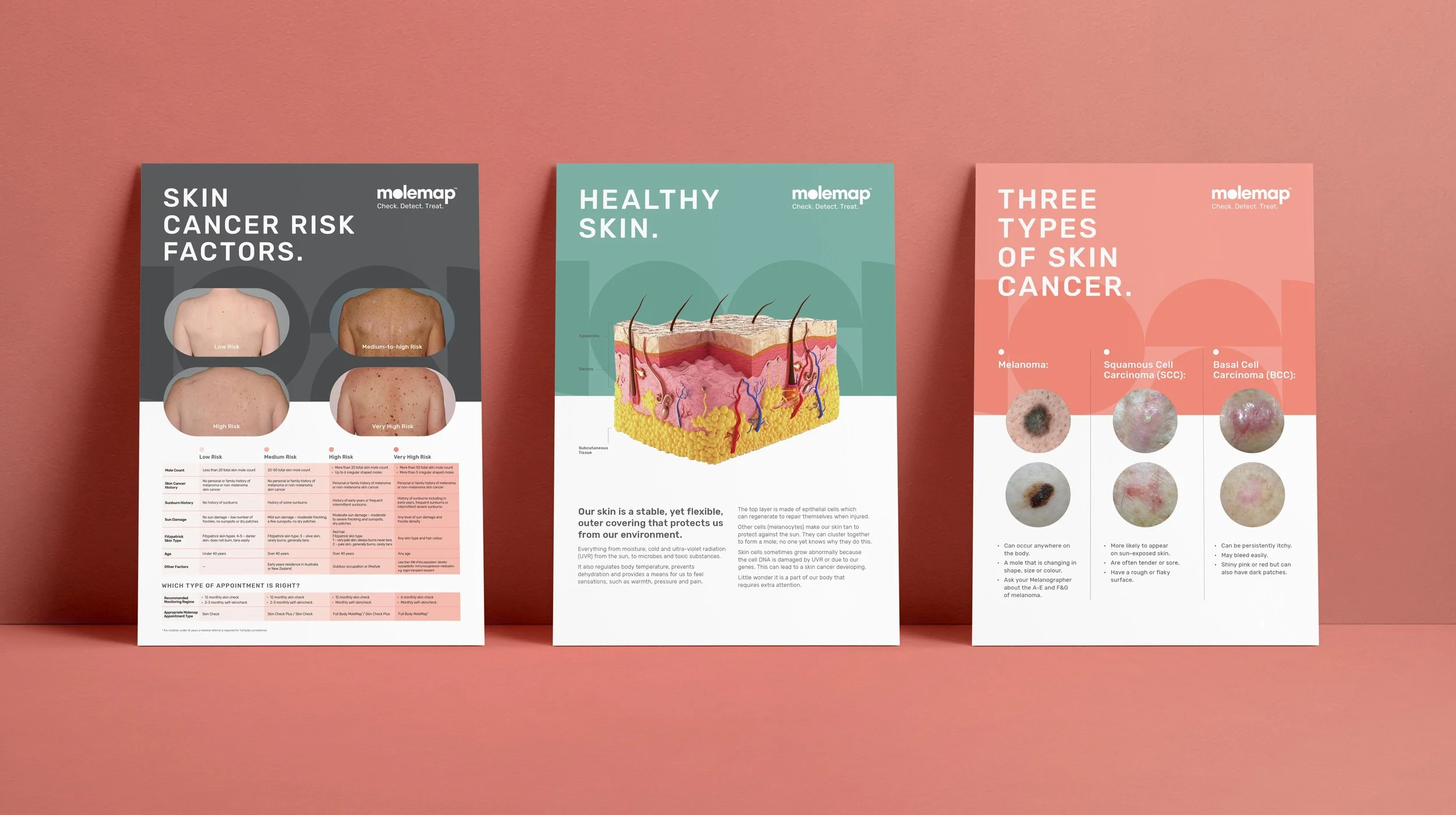 Three educational posters about skin cancer stand against a pink wall. The first poster discusses skin cancer risk factors with images of different skin types; the second explains skin structure with a diagram; the third describes three types of skin cancer with images of skin lesions.