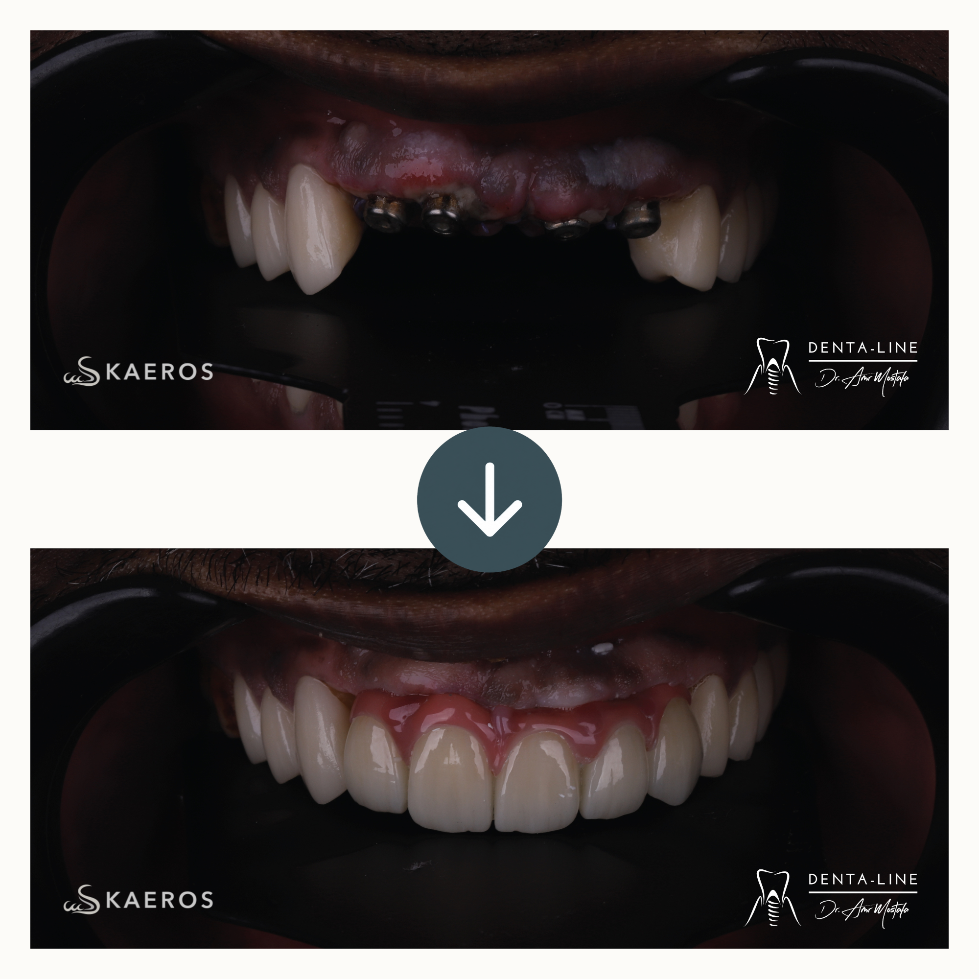 Full Smile Rehab 5.png
