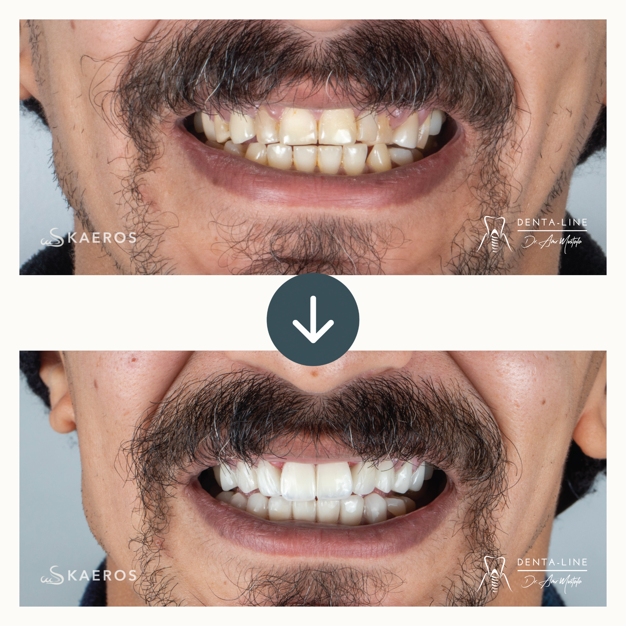 Full Smile Rehab 2.png
