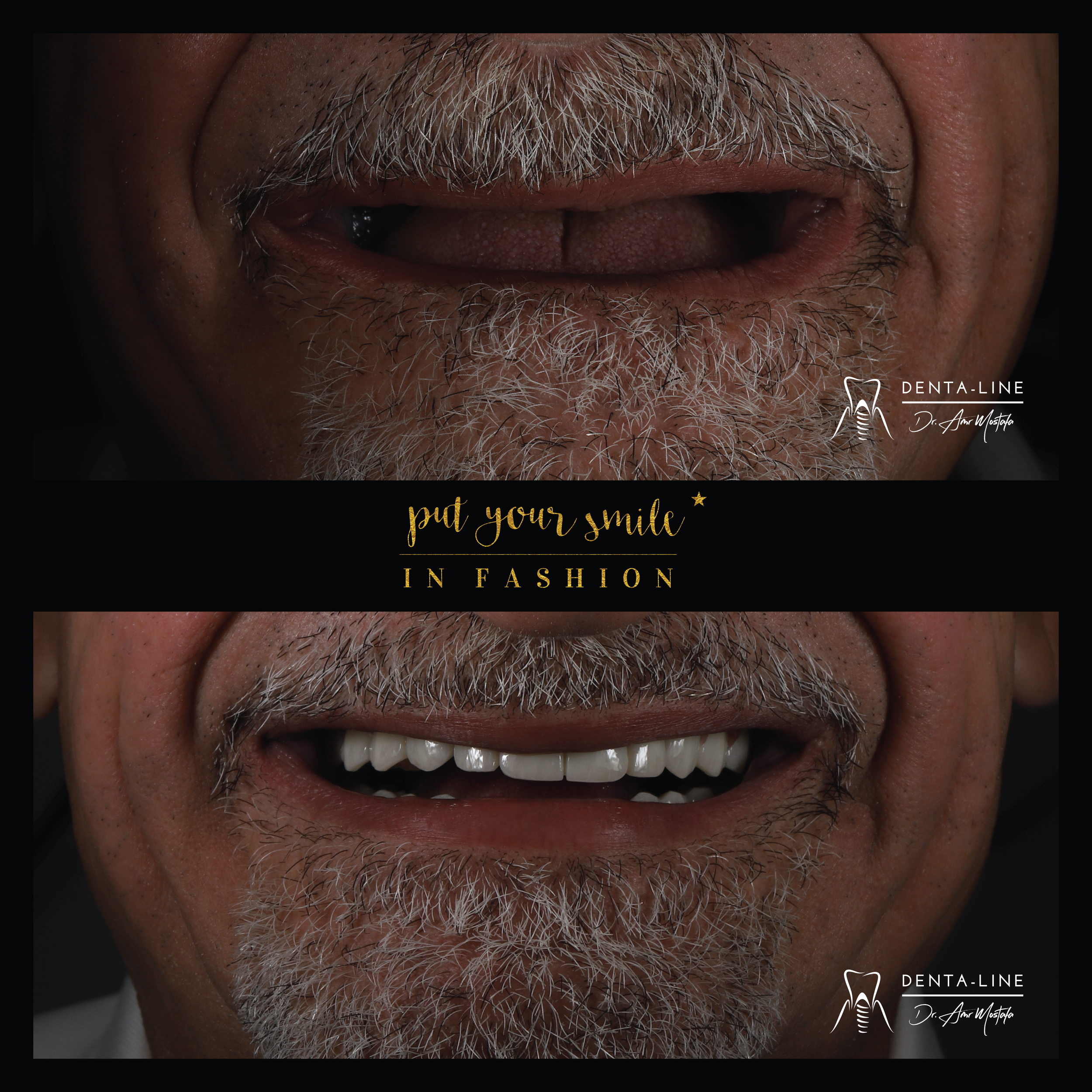 b&a 1 3 (reduced).png