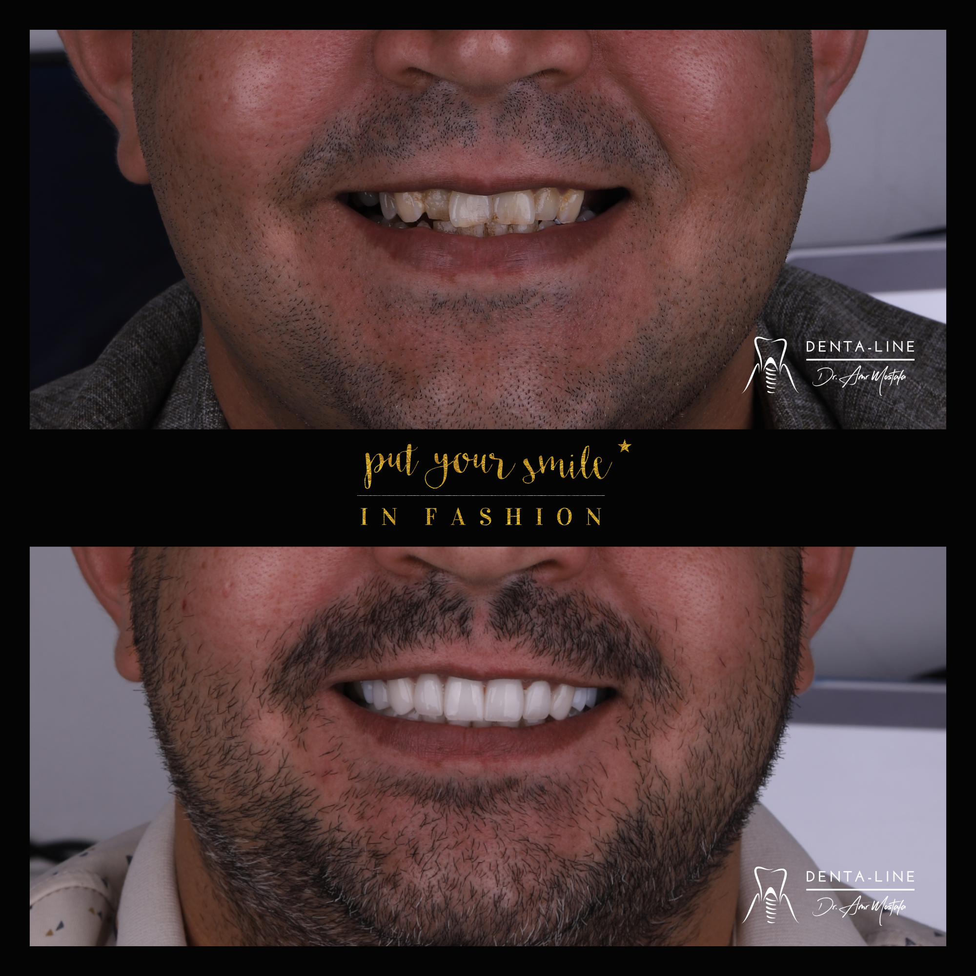 b&a 11.png