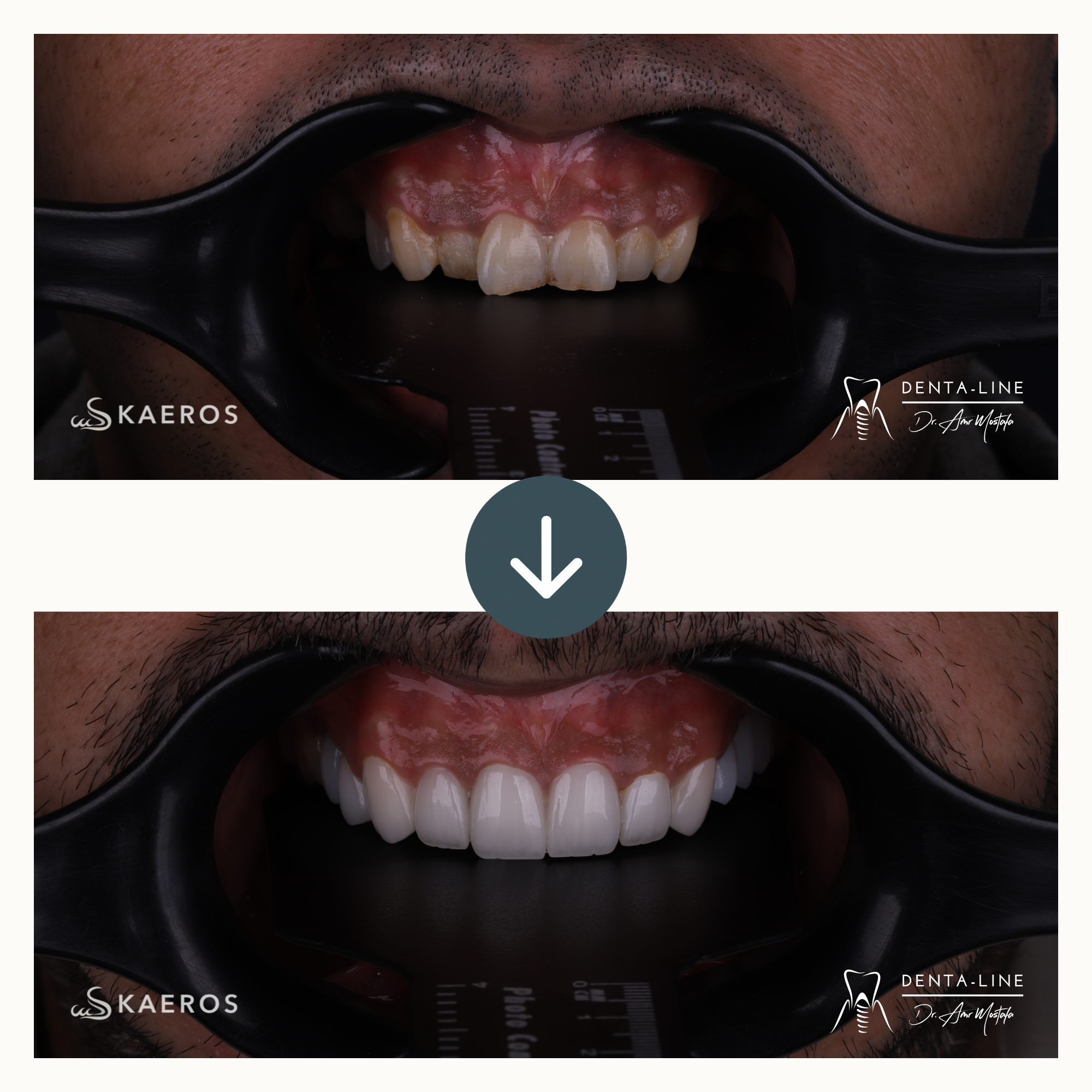 Full Smile Rehab 6.png