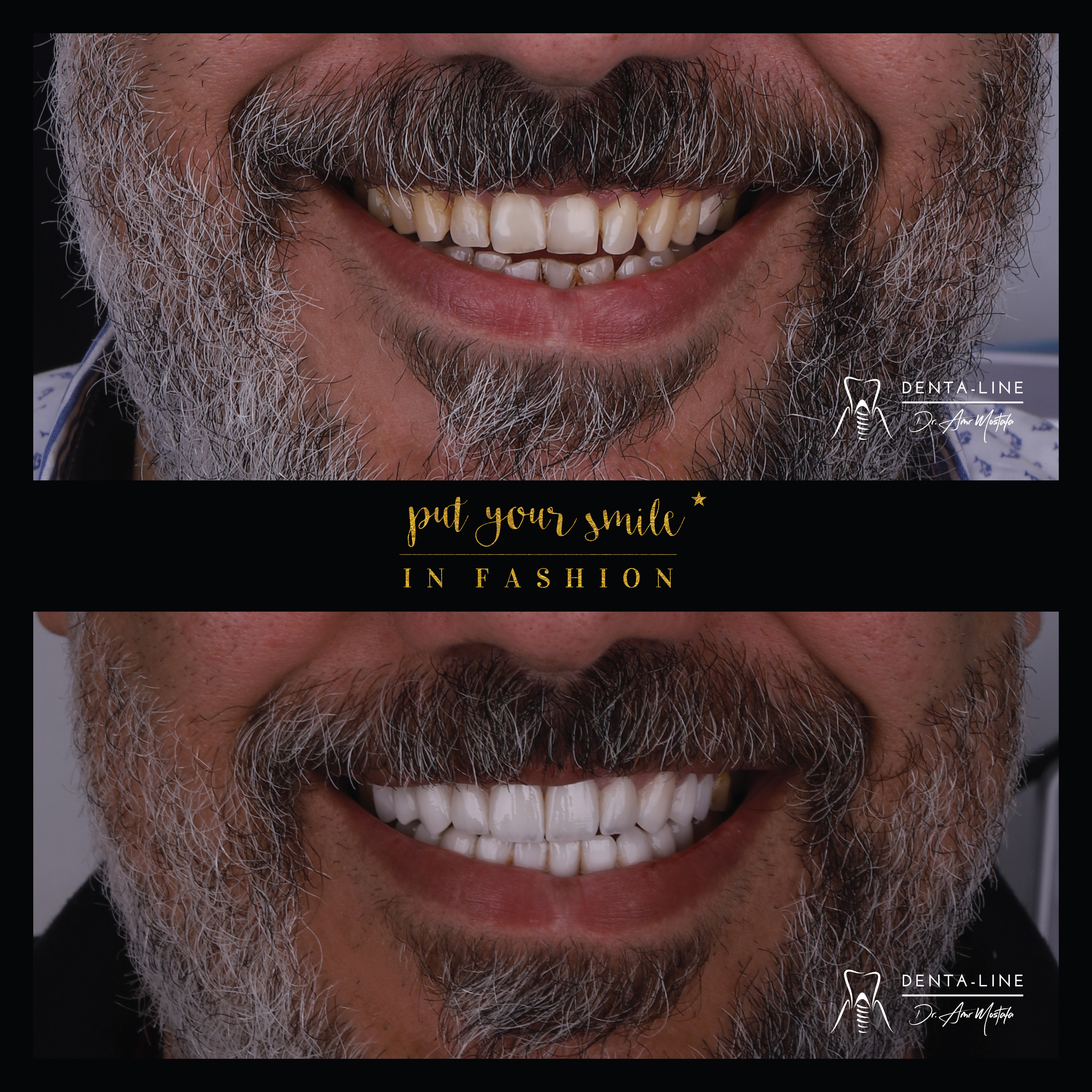 b&a 4 (reduced).png