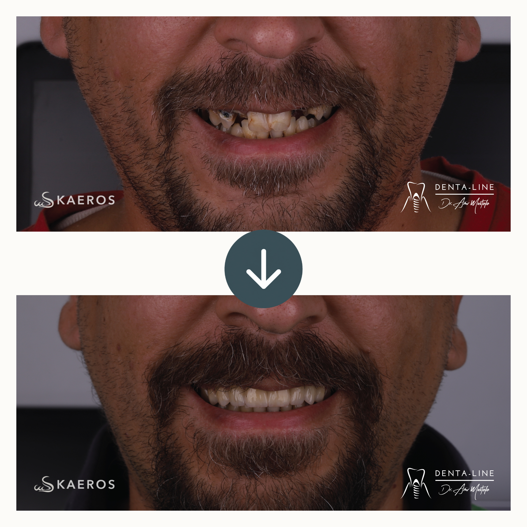 Full Smile Rehab 3.png