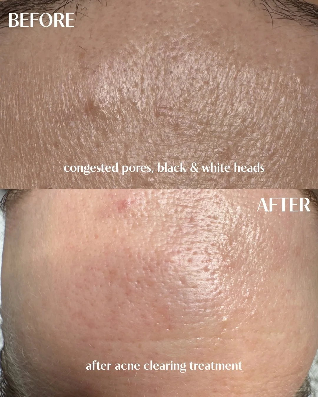 Solving your skin care concerns one appointment at a time. Real results, instantly. Visit the link in my bio to book.