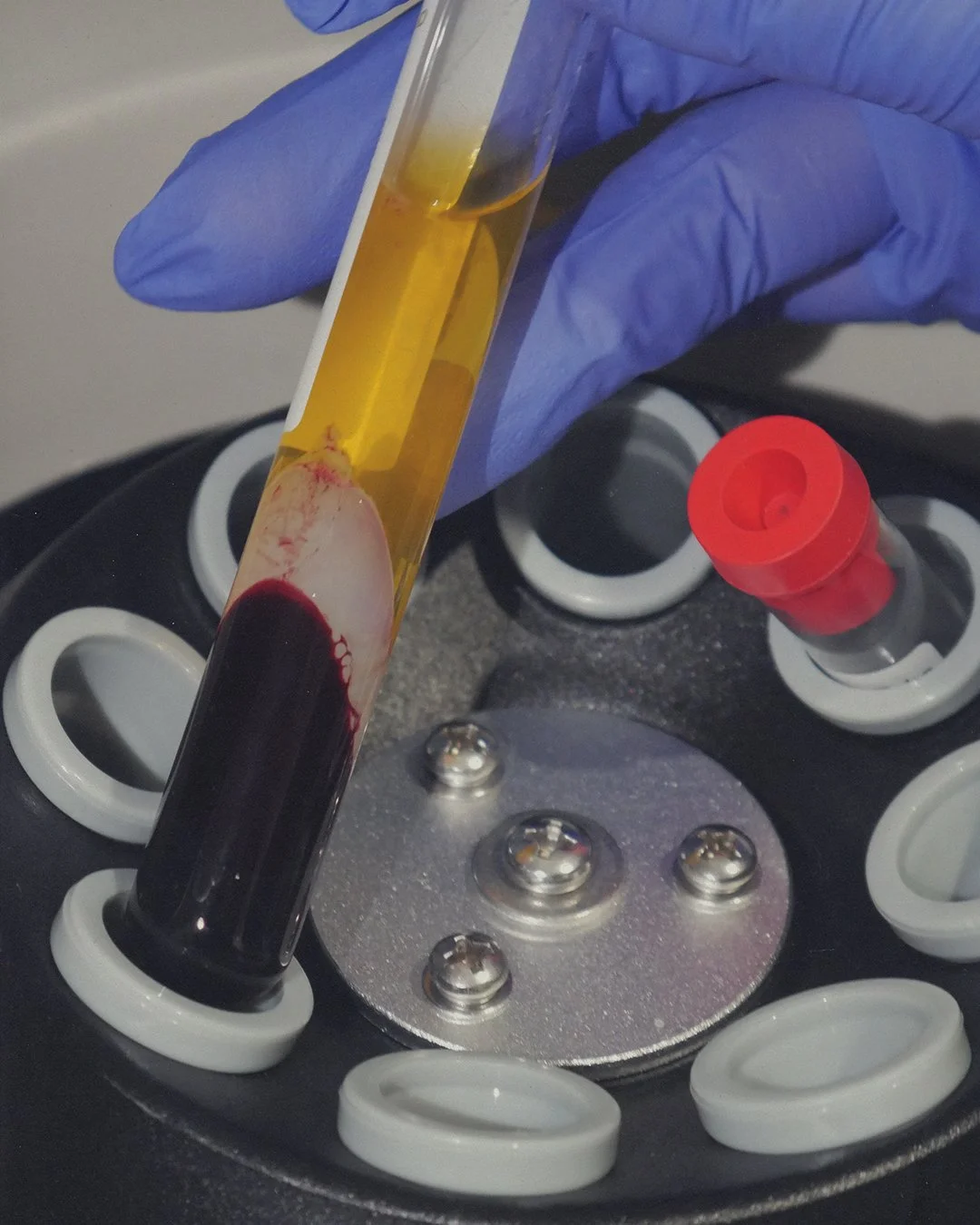 A gloved hand holding a test tube with a yellow liquid, with blood collected at the bottom, placed on a laboratory centrifuge with several other empty slots.