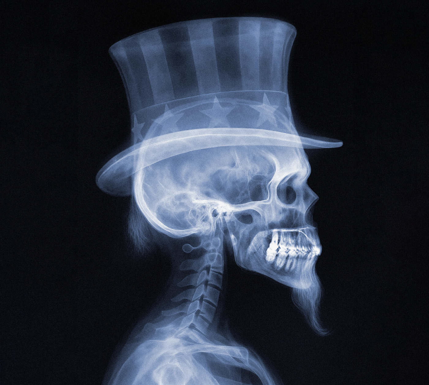 Uncle Sam Dead