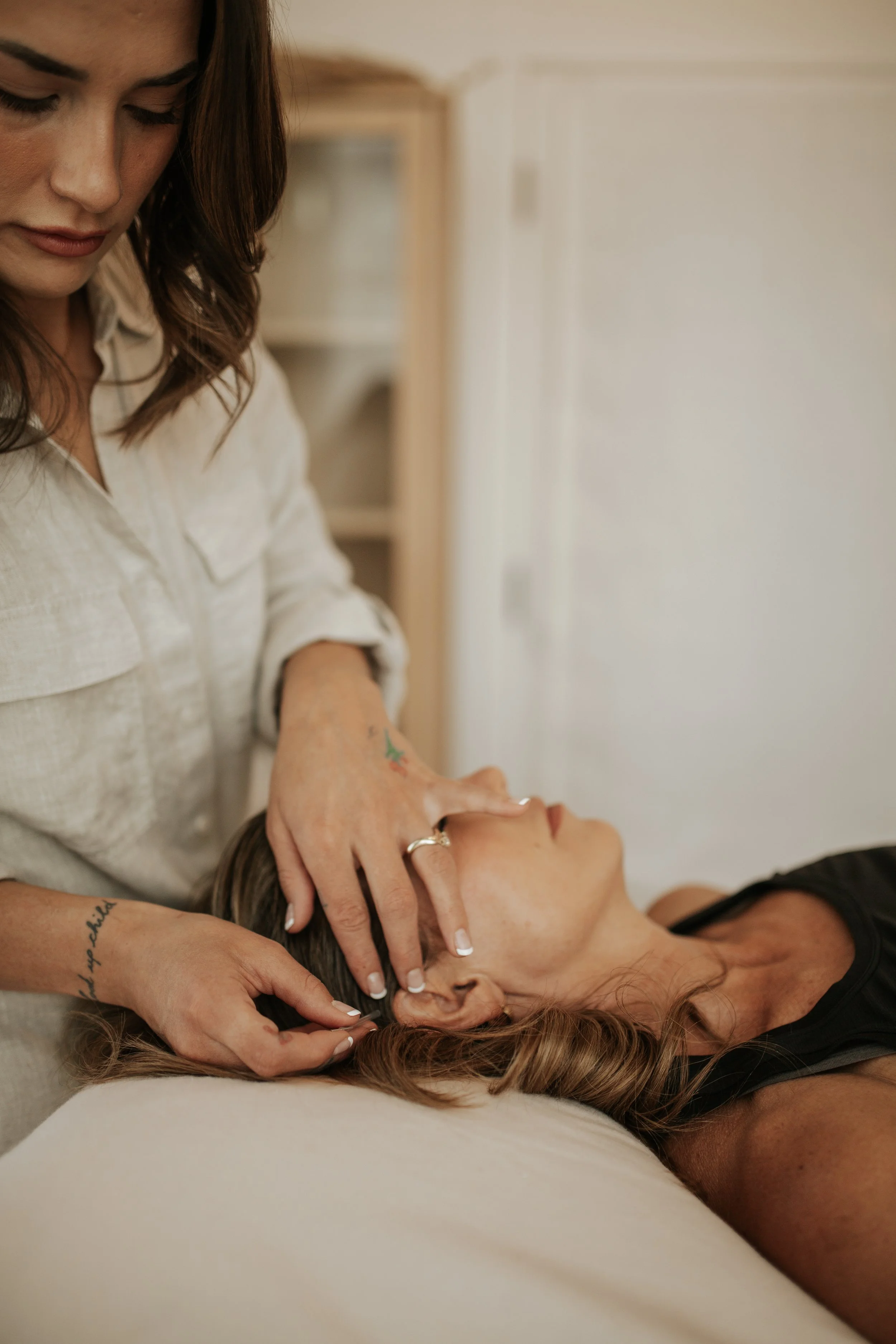 Acupuncturist placing acupuncture needles during treatment at Ezer Wellness.
