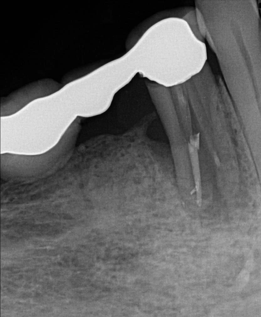 Diagnostic pre-treatment image 3