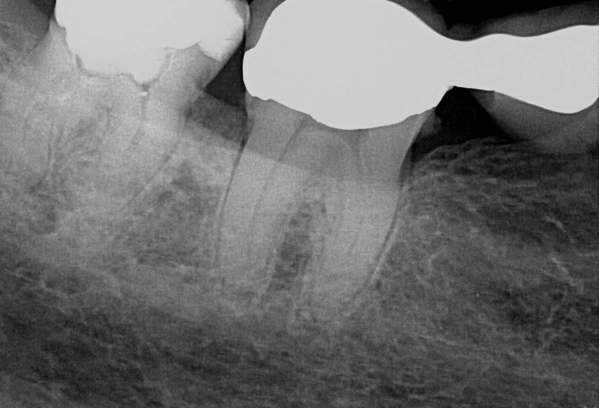 Diagnostic pre-treatment image 2