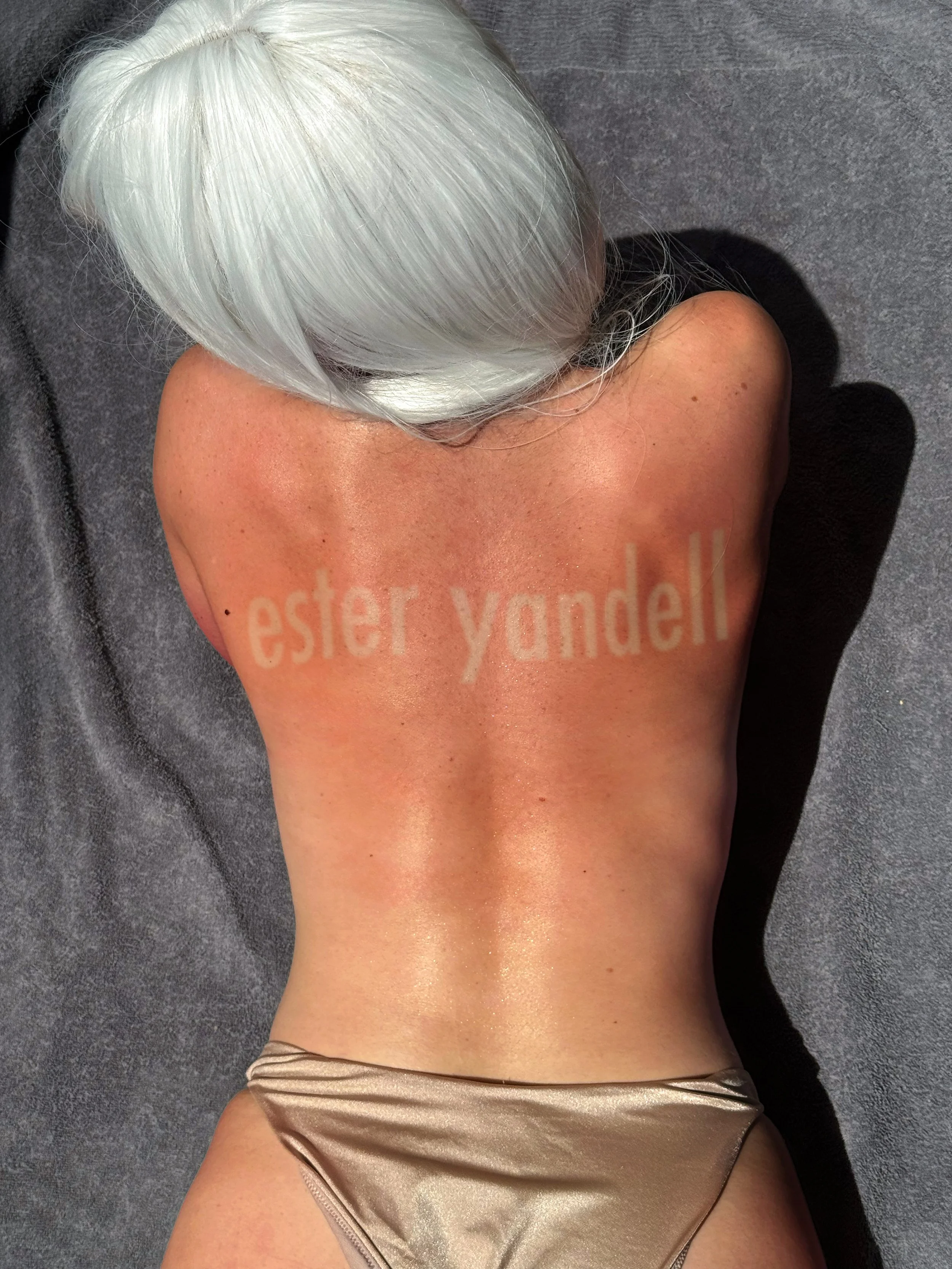 A person with white hair lying face down on a grey towel. Their back is visibly sunburnt and red, with distinct pale tan lines across the shoulder blades spelling out the name of the artist: ester yandell.