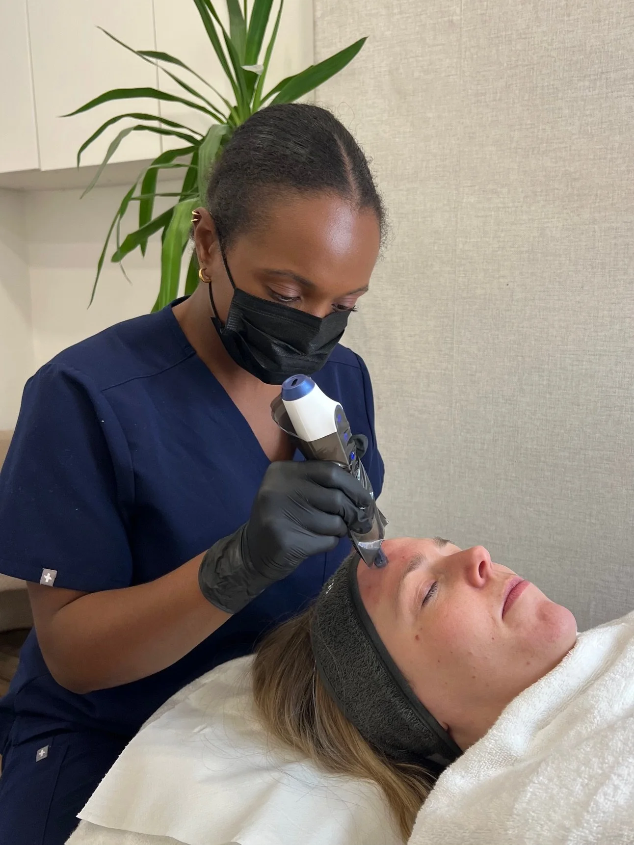 Microneedling in Ilkley